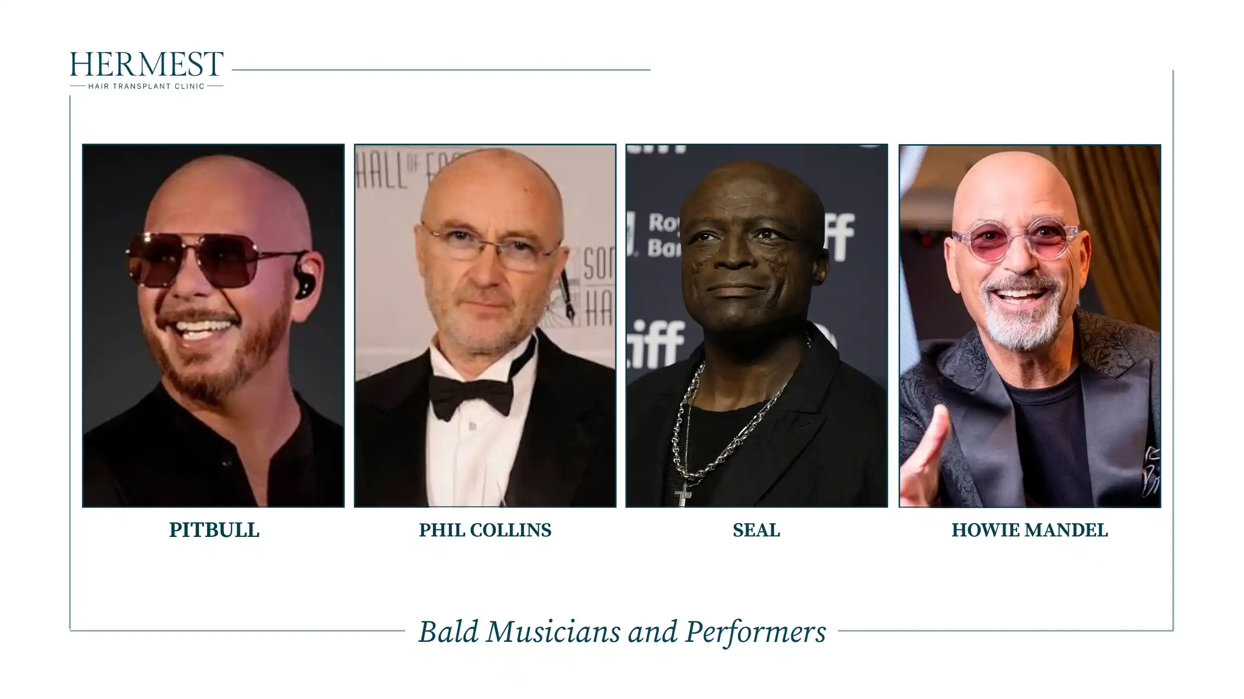 Bald musicians and performers Pitbull, Phil Collins, Seal and Howie Mandel