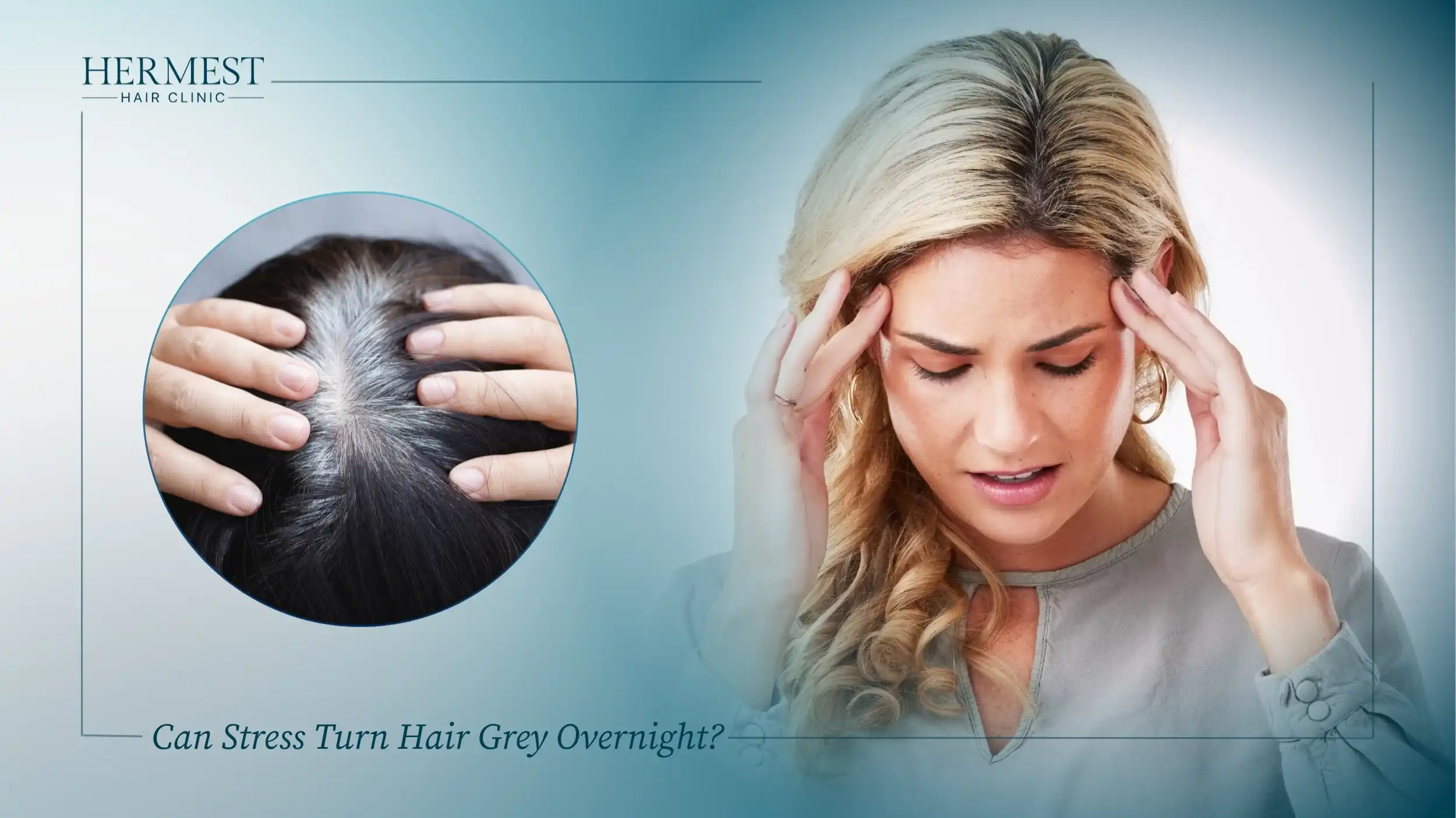 Can Stress Turn Hair Grey Overnight