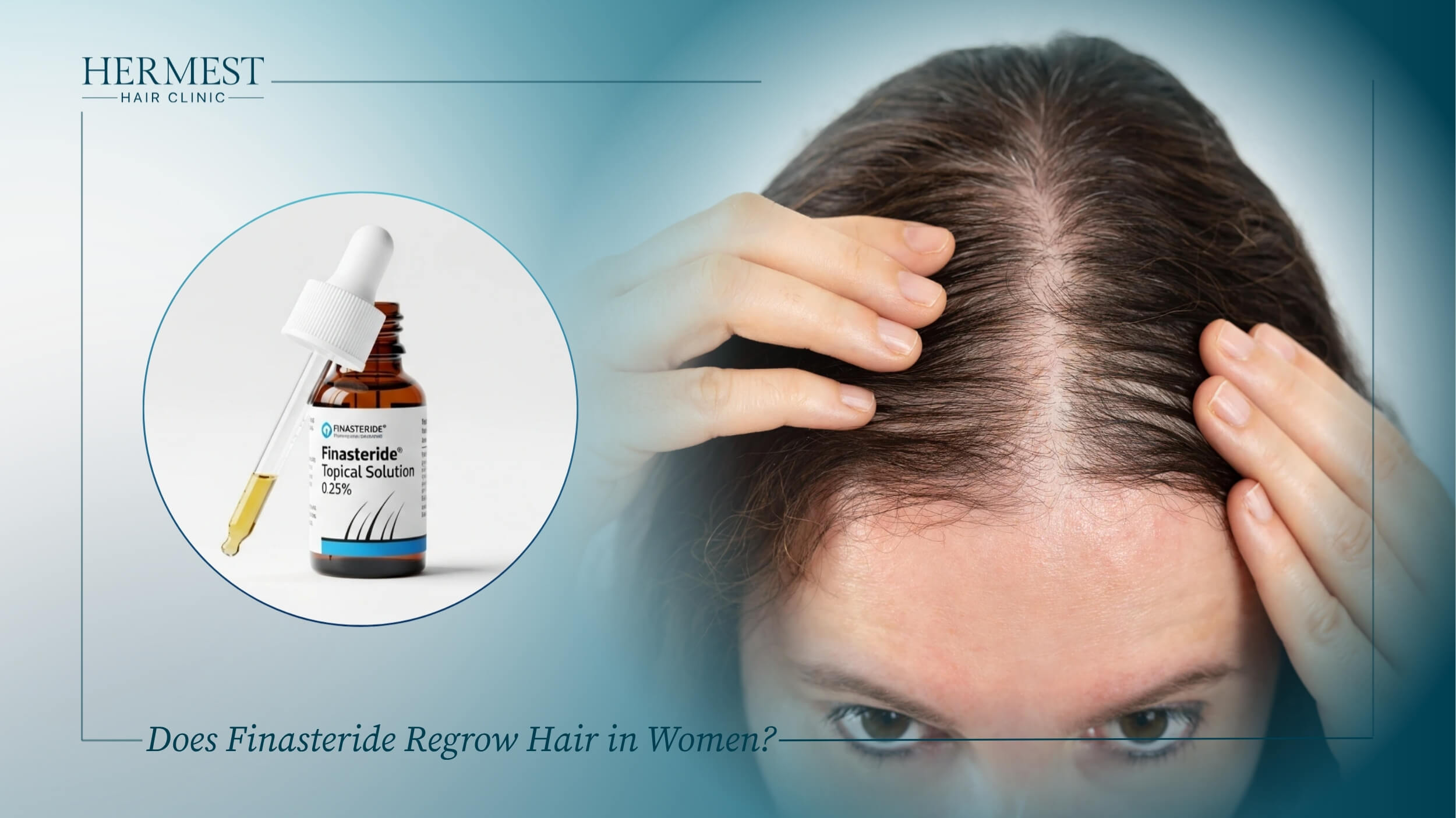 Does Finasteride Regrow Hair in Women