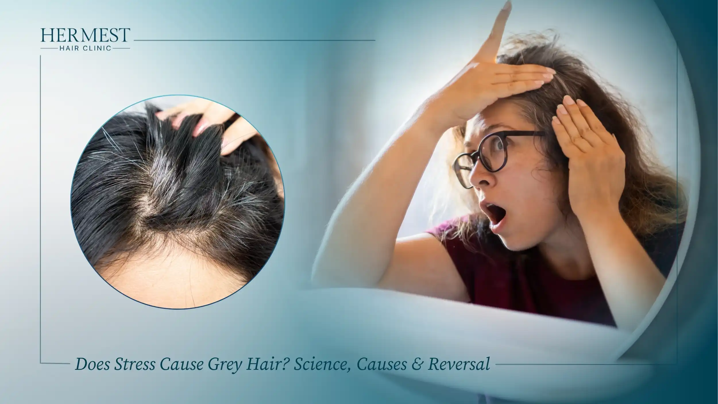 Does Stress Really Cause Grey Hair