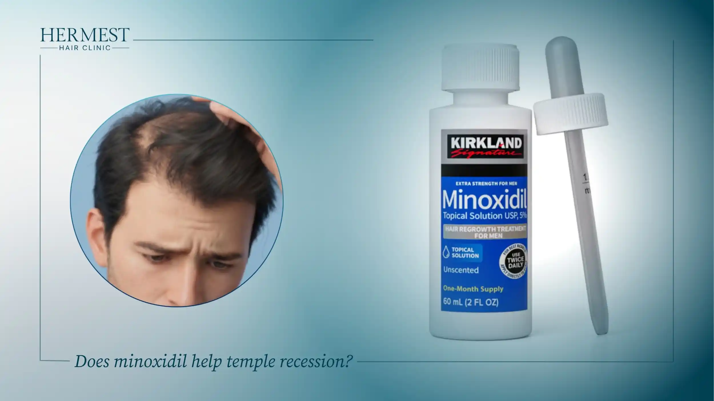 Worried man showing temple recession beside a bottle of 5% minoxidil topical solution and dropper