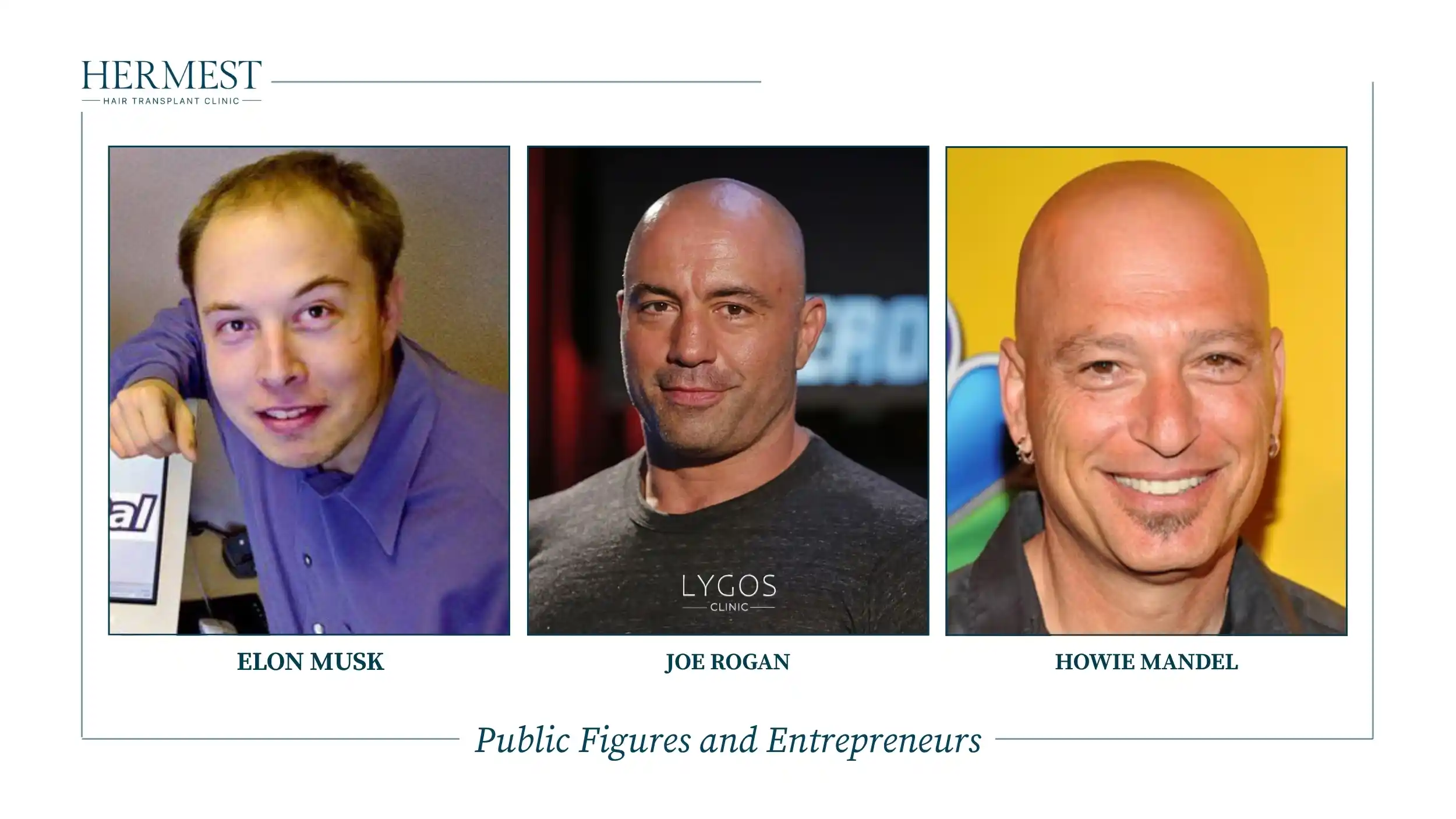 Young Elon Musk with thinning hair, Joe Rogan and Howie Mandel as public figures with hair loss