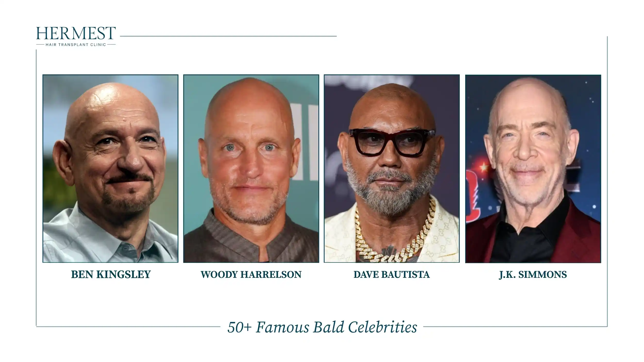 Bald actors Ben Kingsley, Woody Harrelson, Dave Bautista and J.K. Simmons