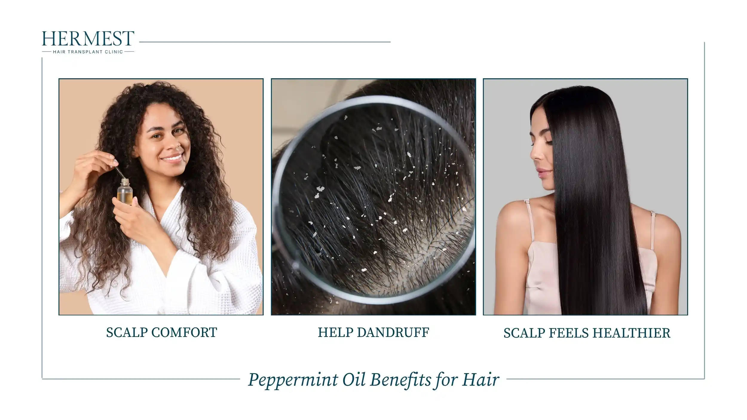 Peppermint Oil Benefits for Hair