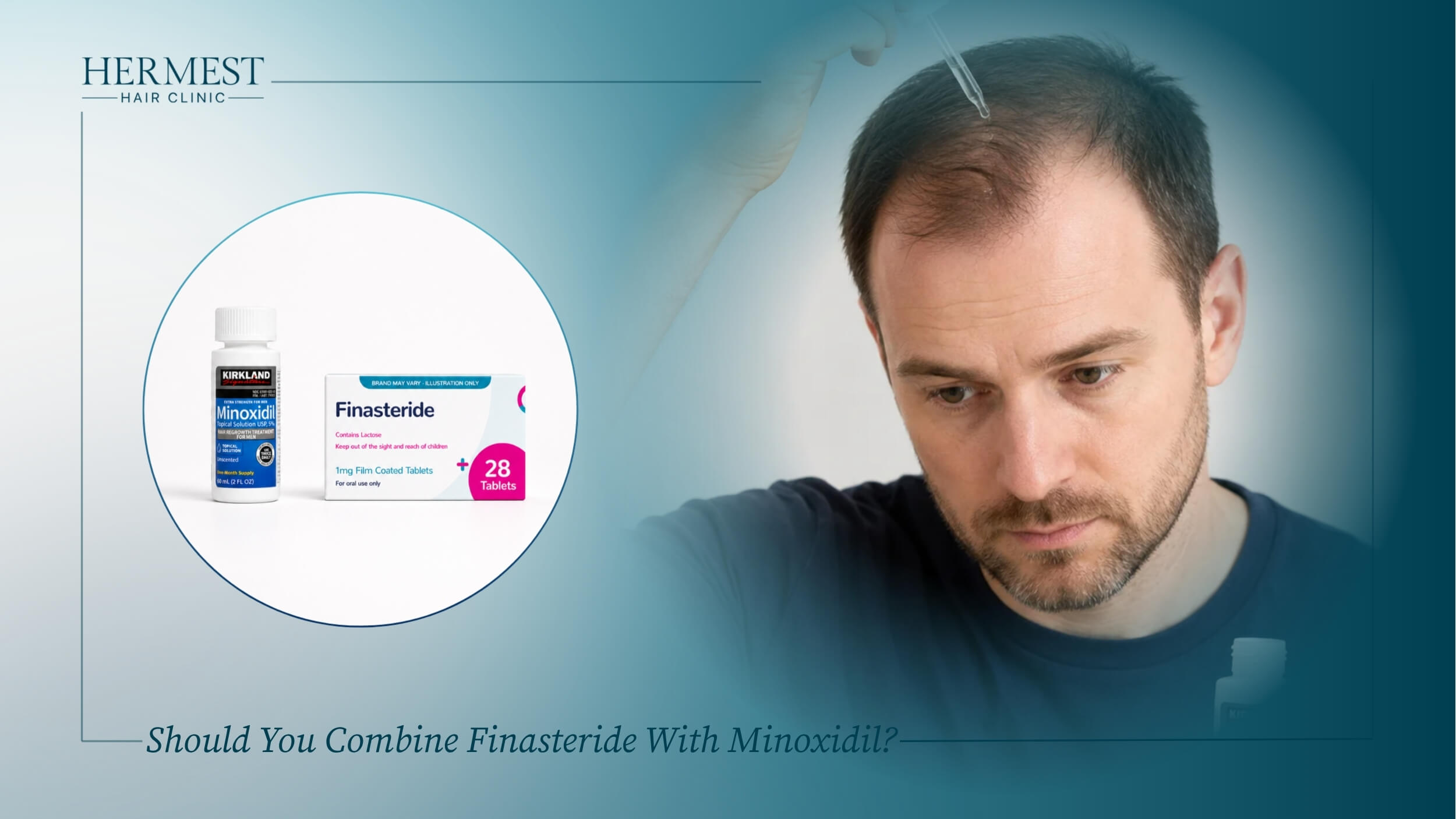 Should You Combine Finasteride With Minoxidil