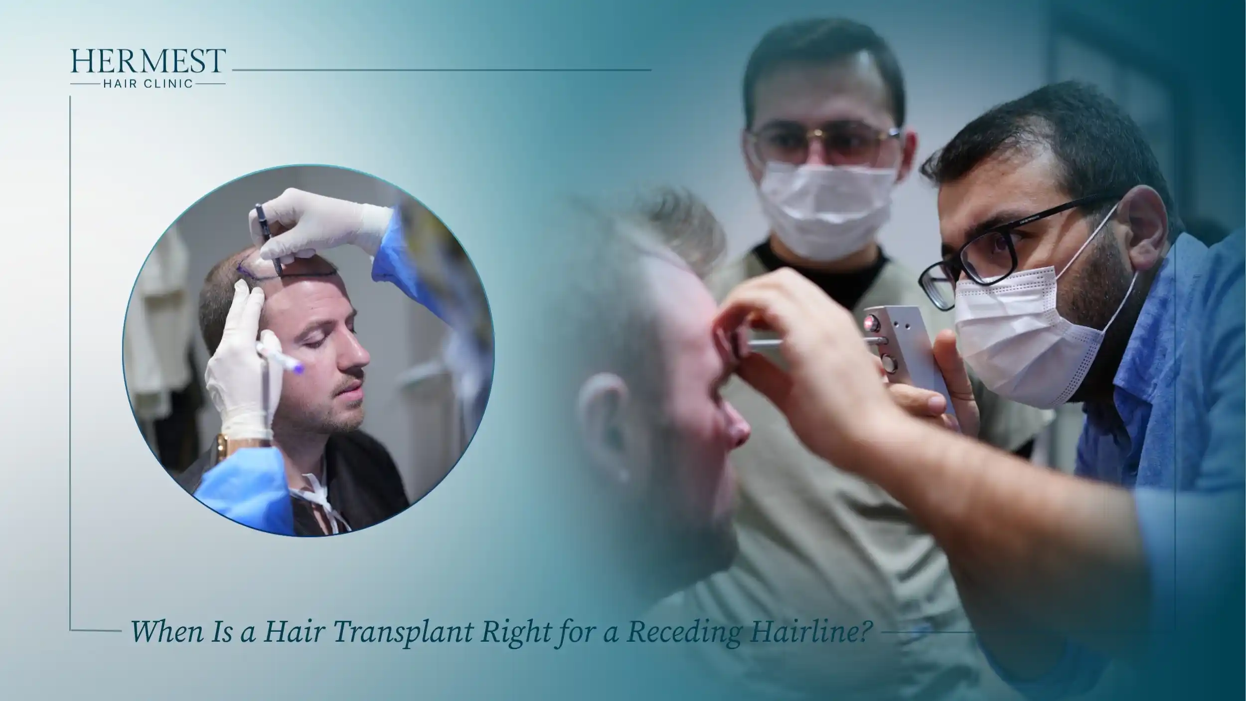 Doctors marking and examining a patient's receding hairline to plan a hair transplant