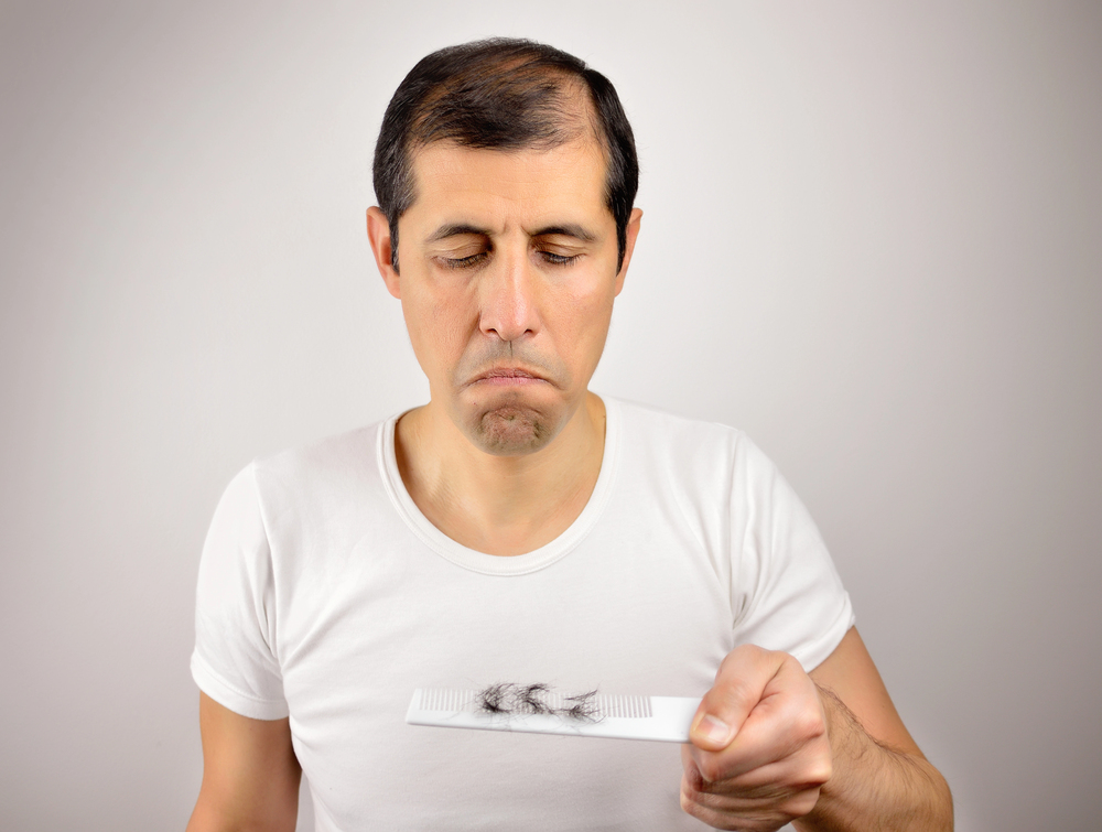 Seasonal Hair Loss: Causes, Recovery & Treatment Guide 2 Seasonal Hair Loss