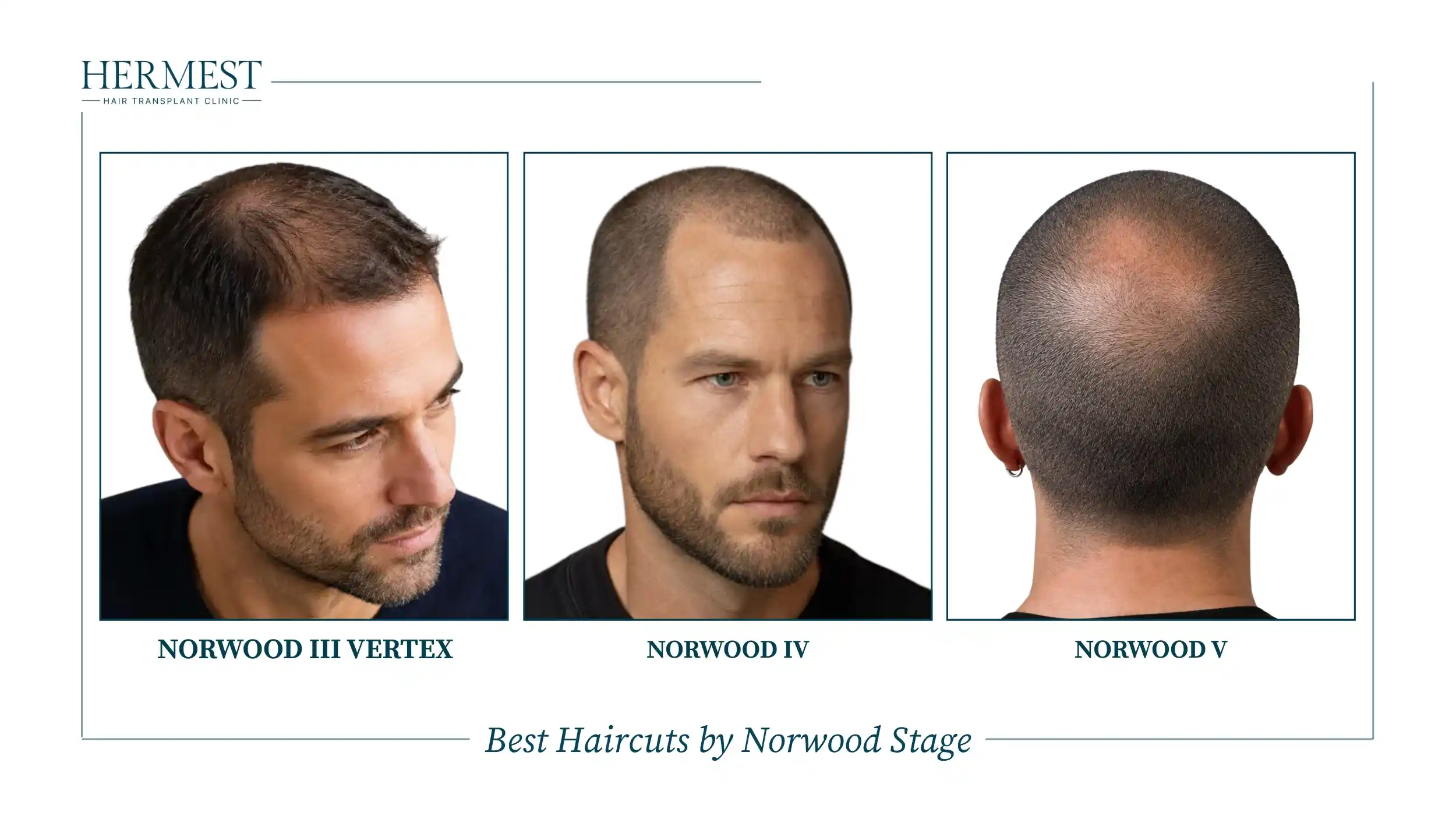 Best Haircuts by Norwood Stage