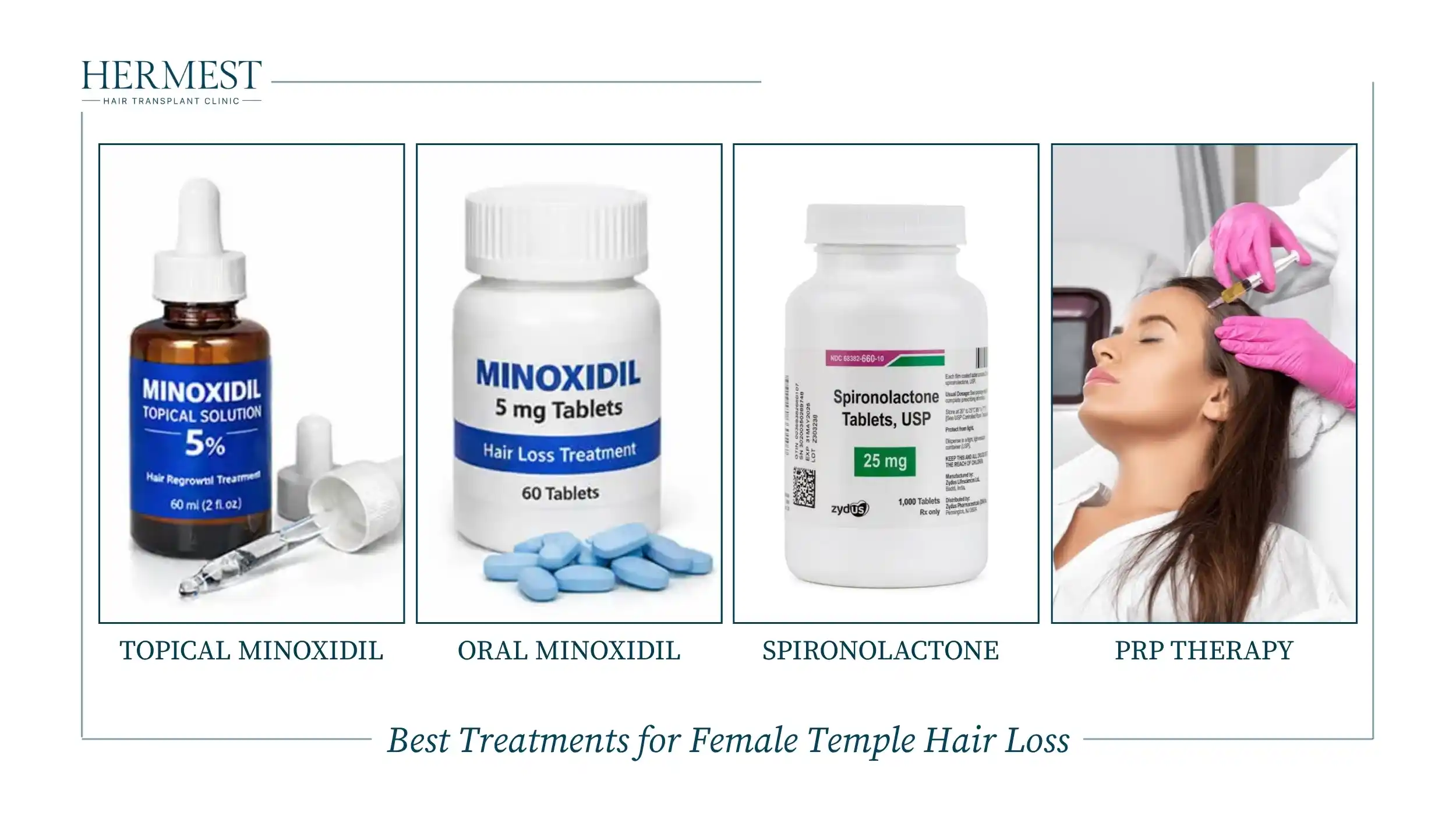 Best Treatments for Female Temple Hair Loss