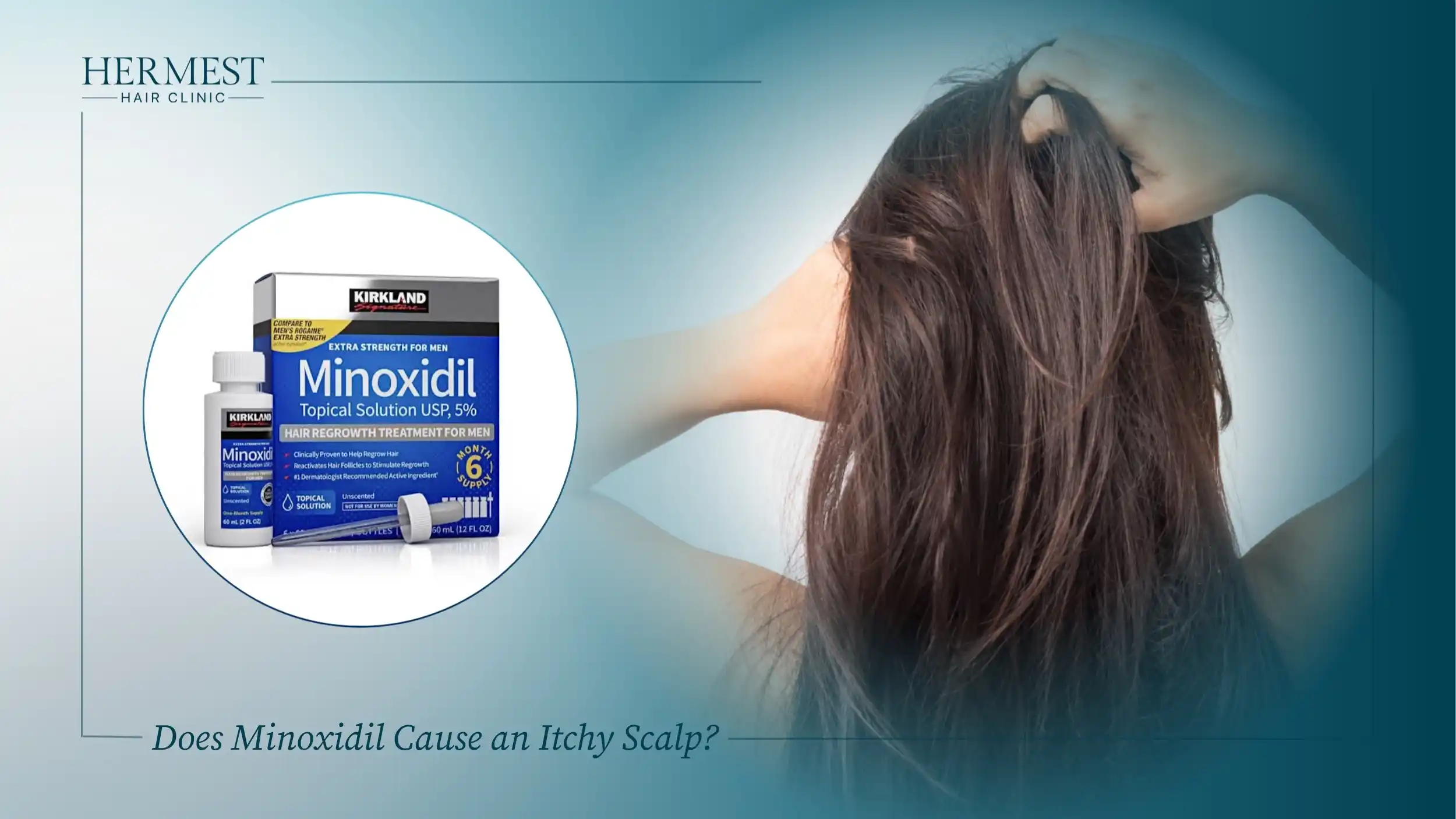 Does Minoxidil Cause an Itchy Scalp