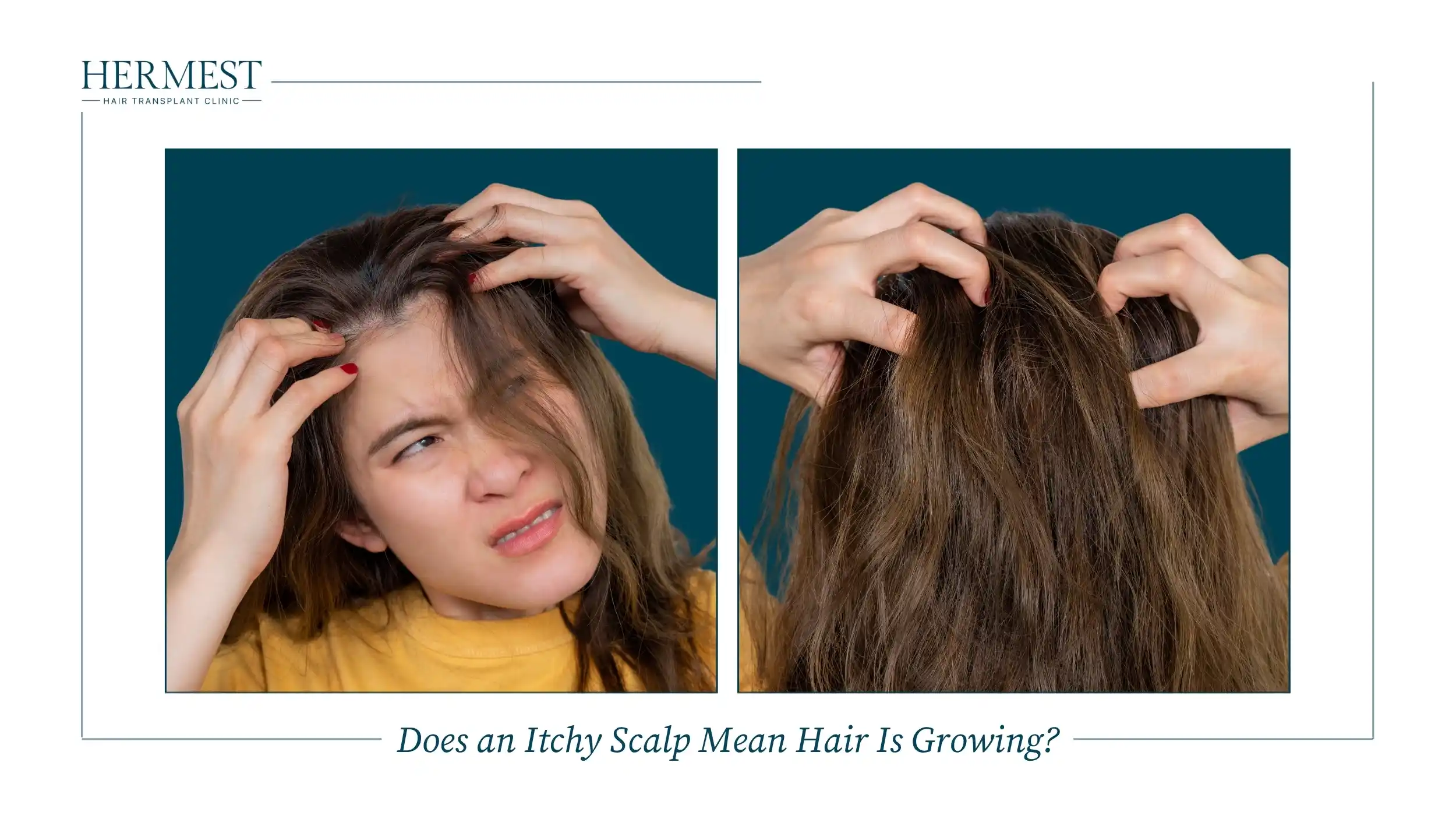 Does an Itchy Scalp Mean Hair Is Growing