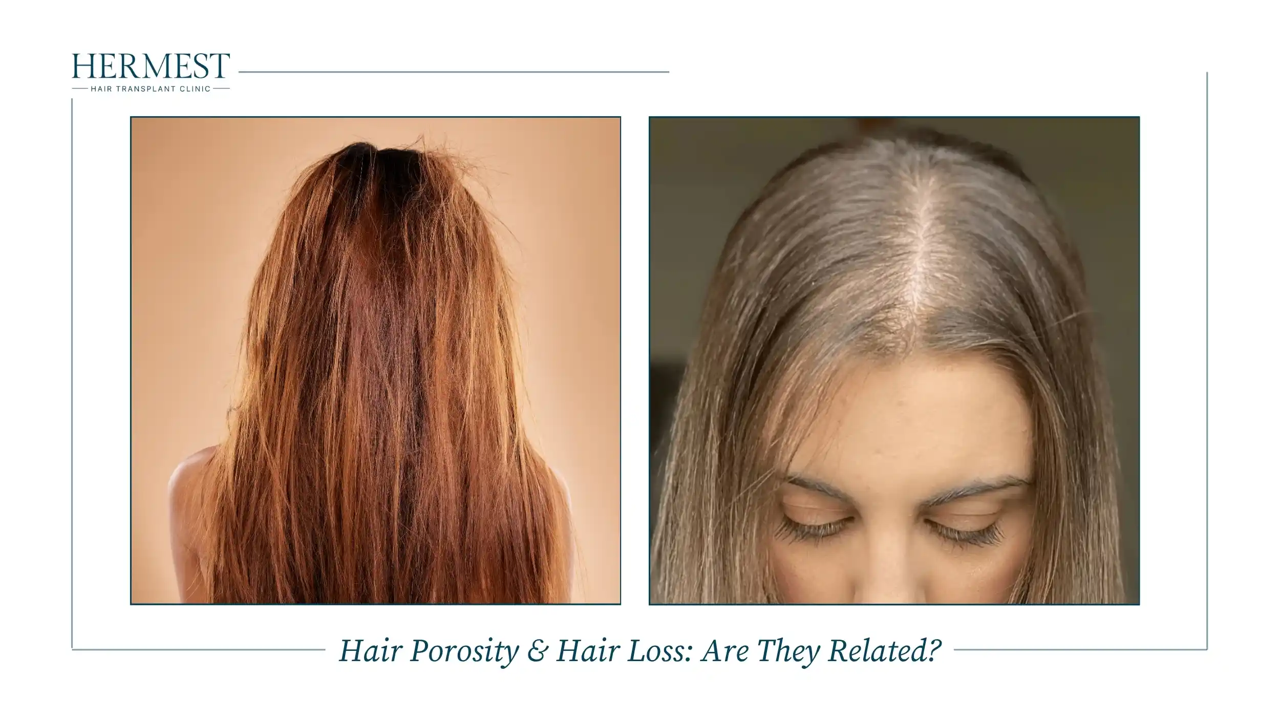 Dry, damaged long hair next to a woman with thinning at the part, asking if hair porosity is linked to hair loss