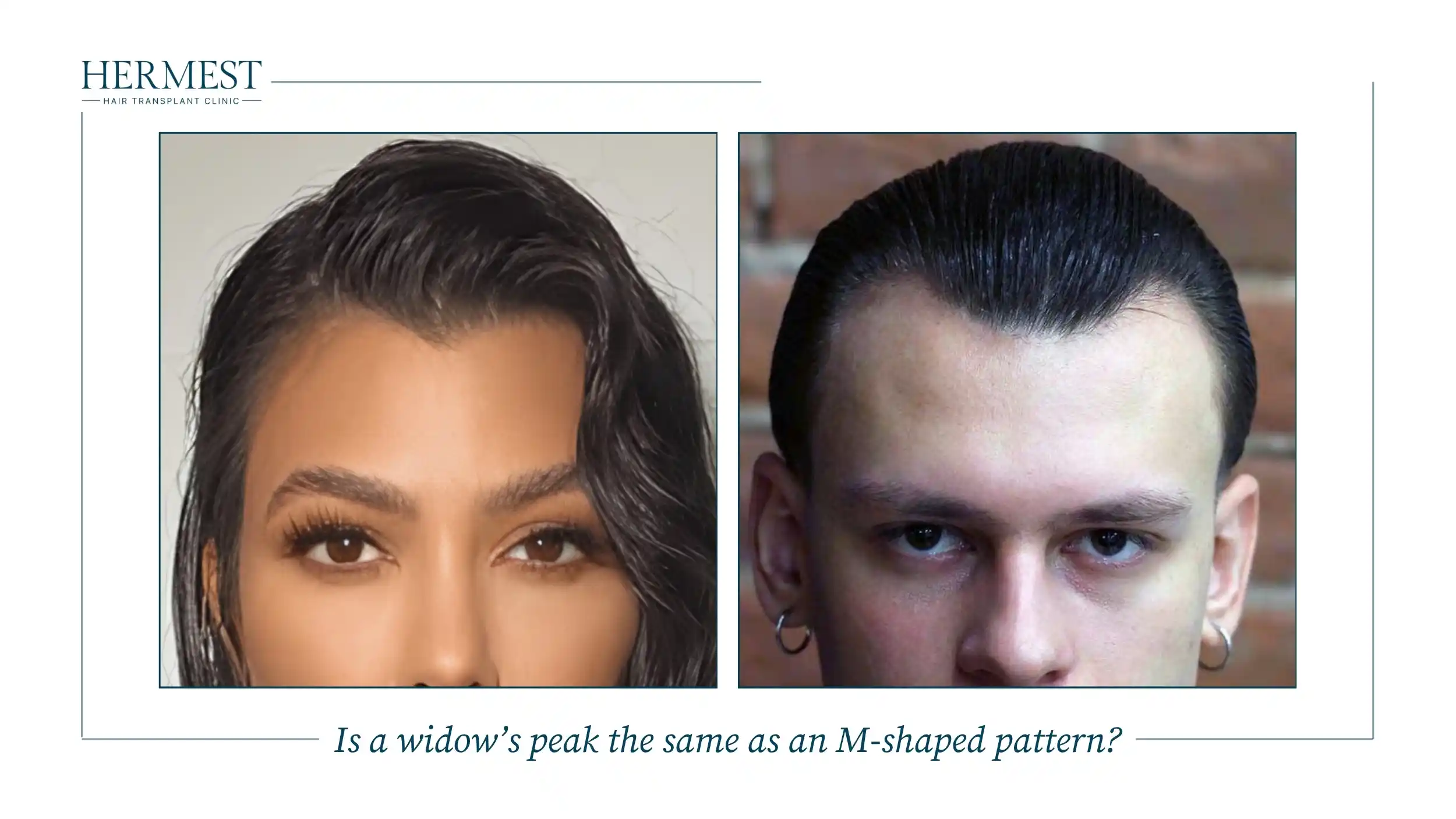 Woman with a widow's peak next to a young man with an M-shaped receding hairline, comparing the two patterns