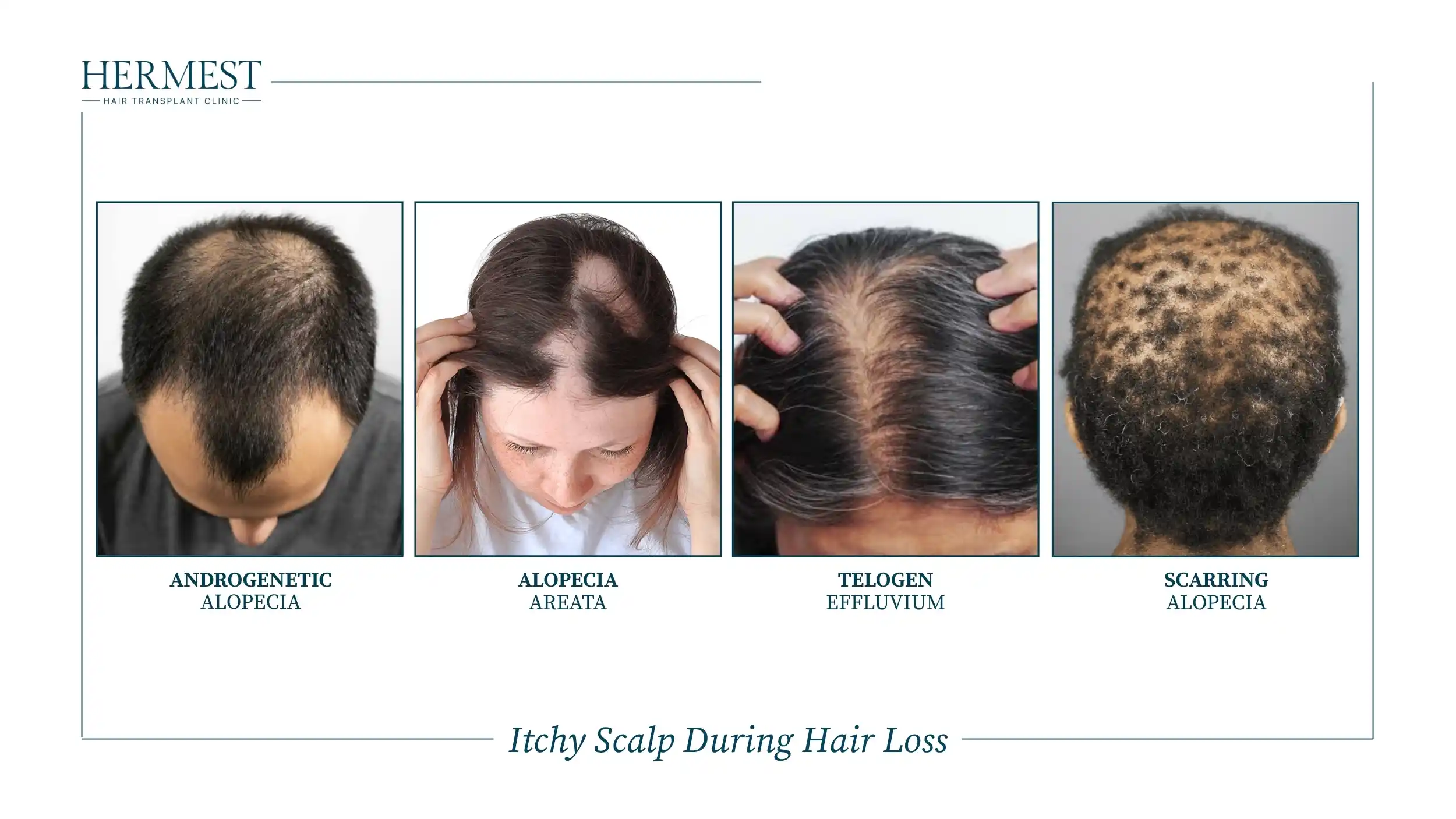 Itchy Scalp During Hair Loss