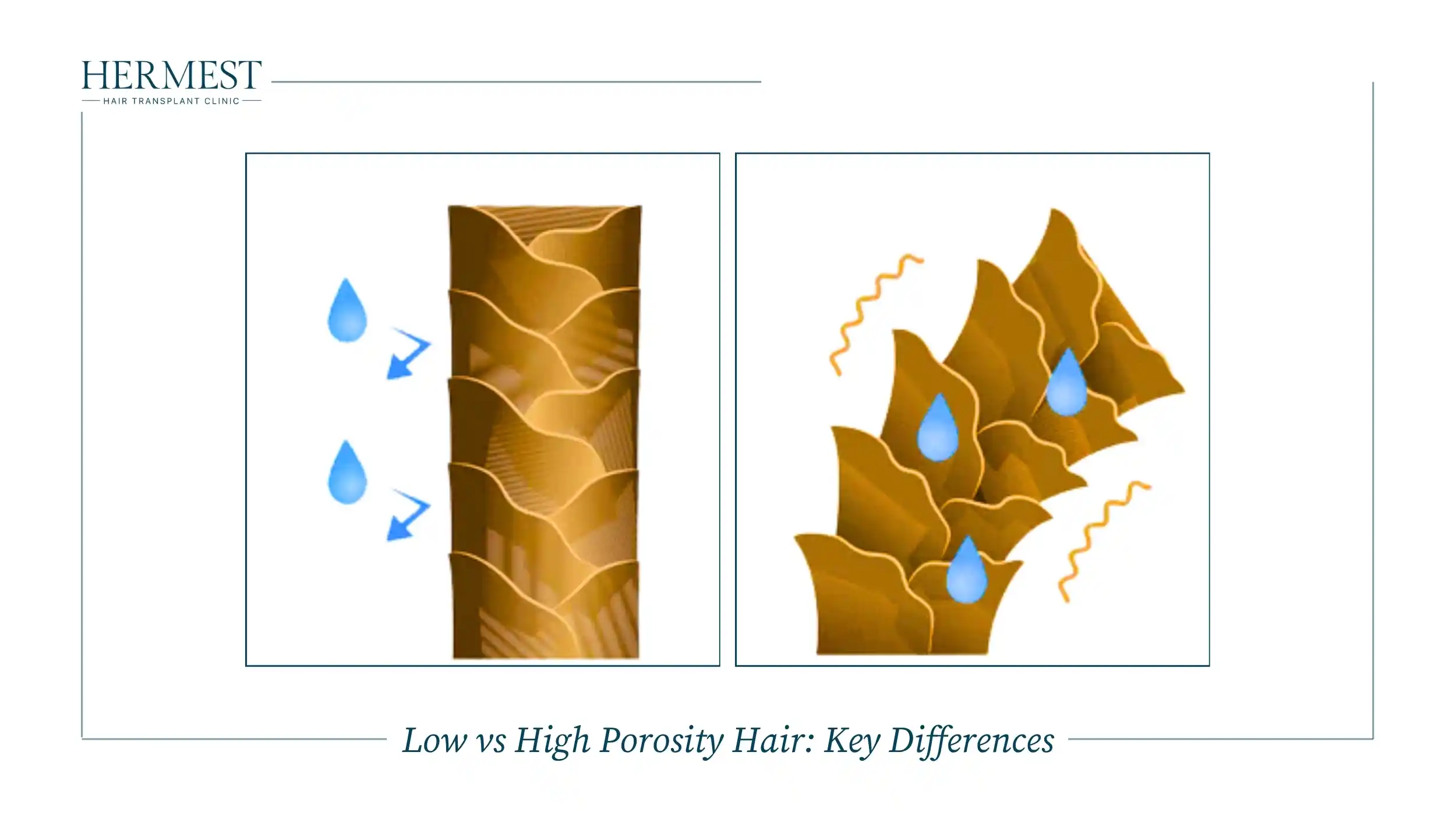Illustration comparing a smooth low porosity strand with closed cuticles and a high porosity strand with open cuticles
