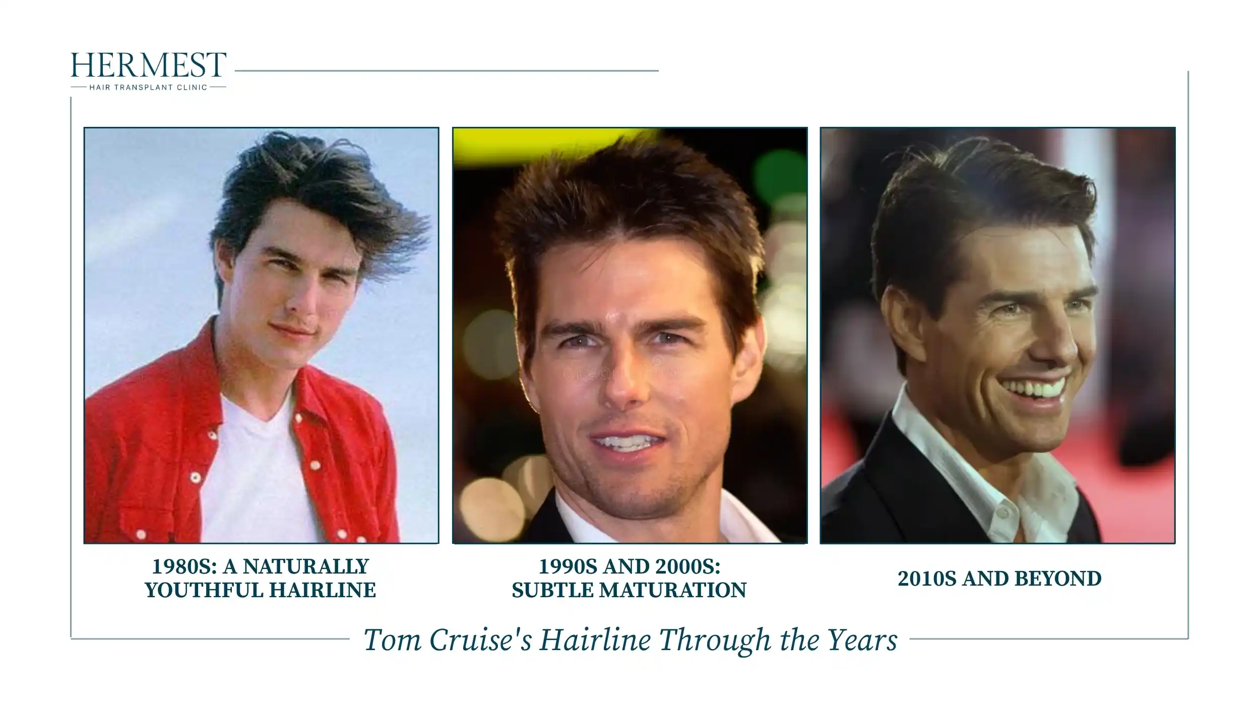 Tom Cruise's Hairline Through the Years