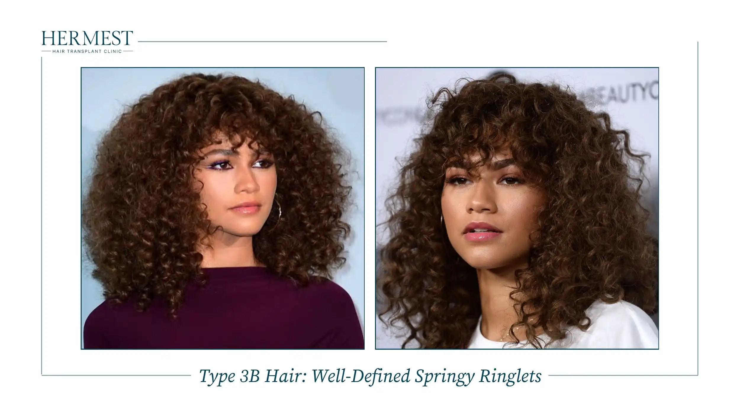 Type 3B Hair Well-Defined Springy Ringlets