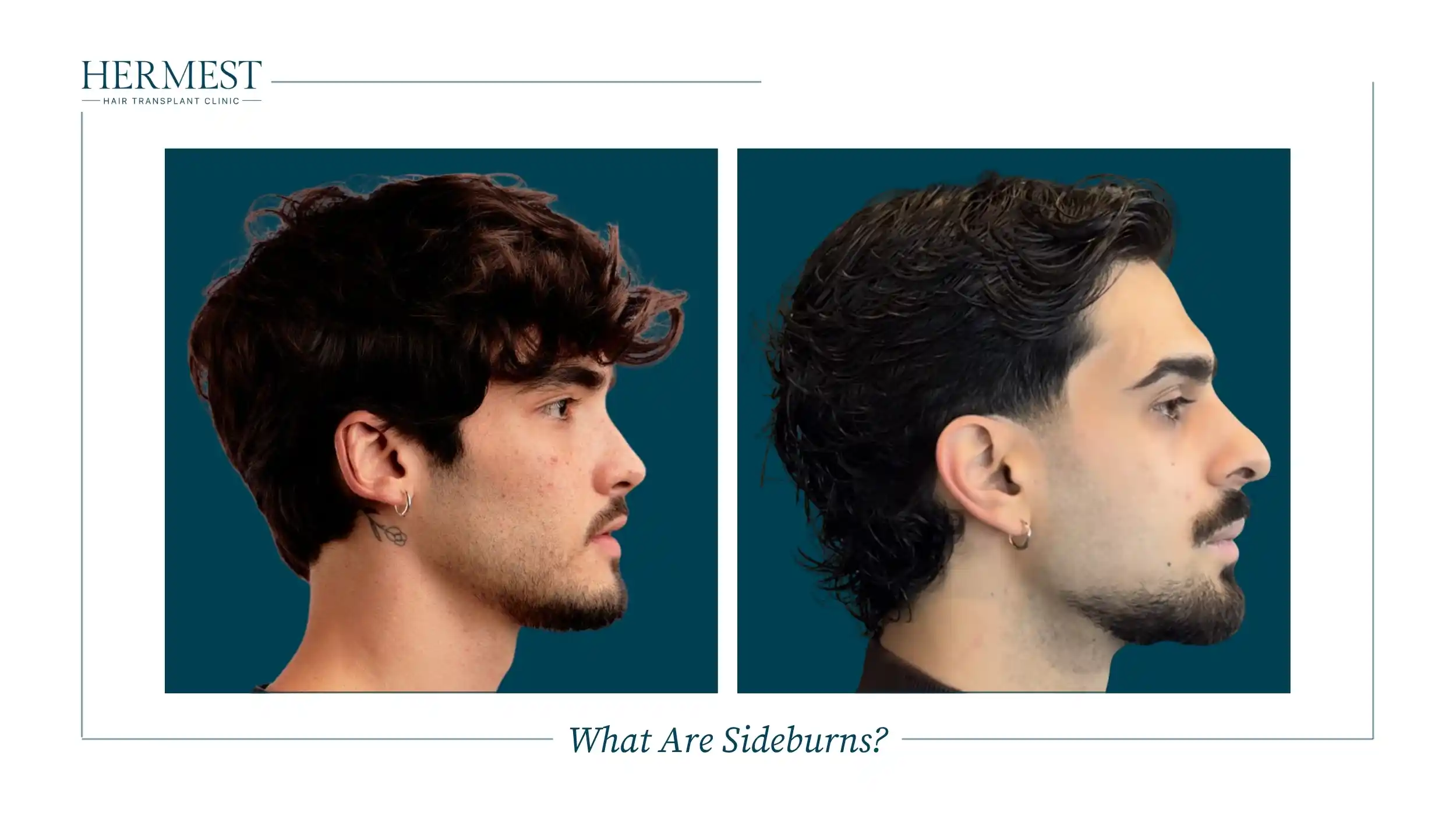 What Are Sideburns