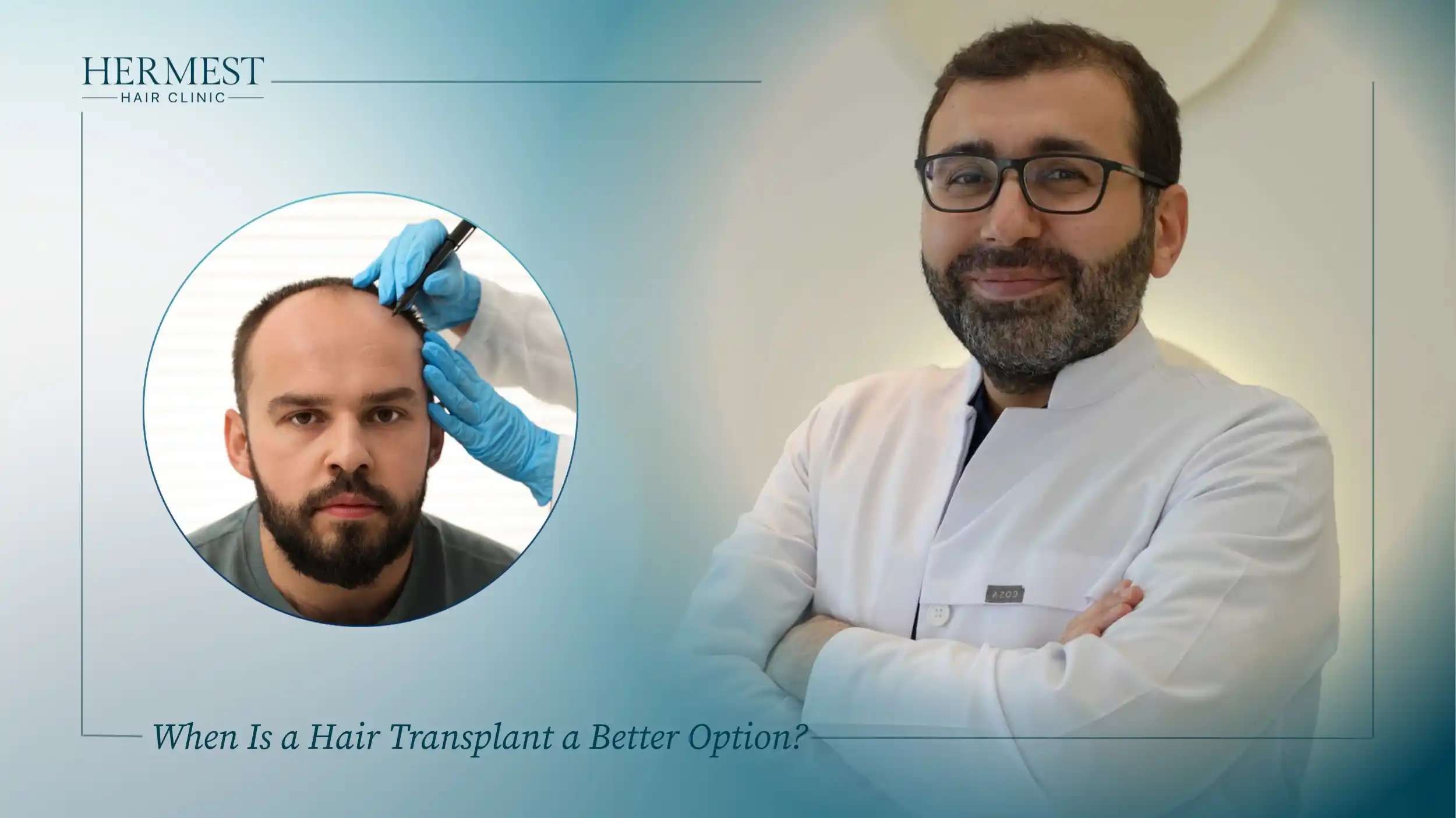 When Is a Hair Transplant a Better Option
