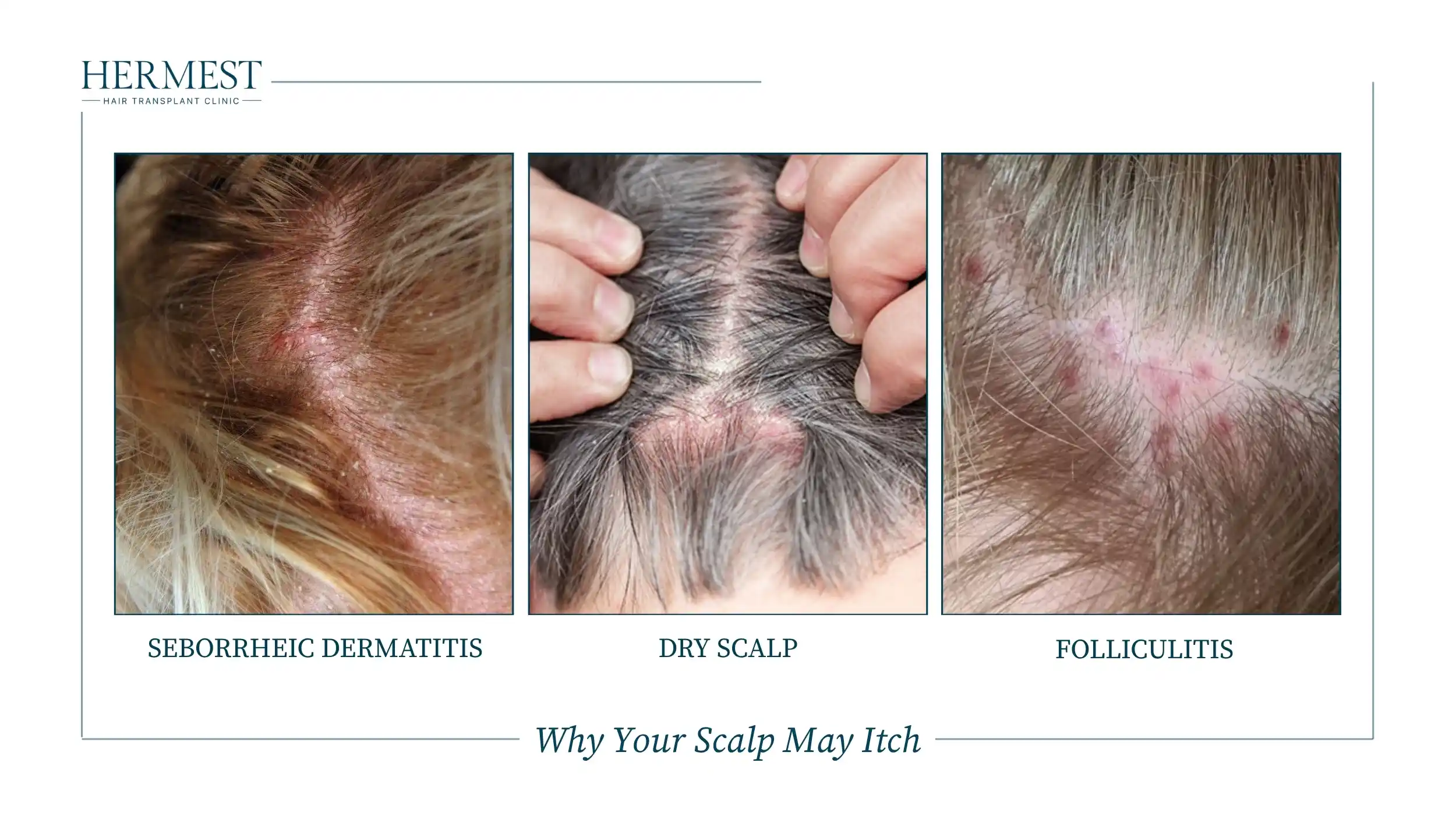 Why Your Scalp May Itch