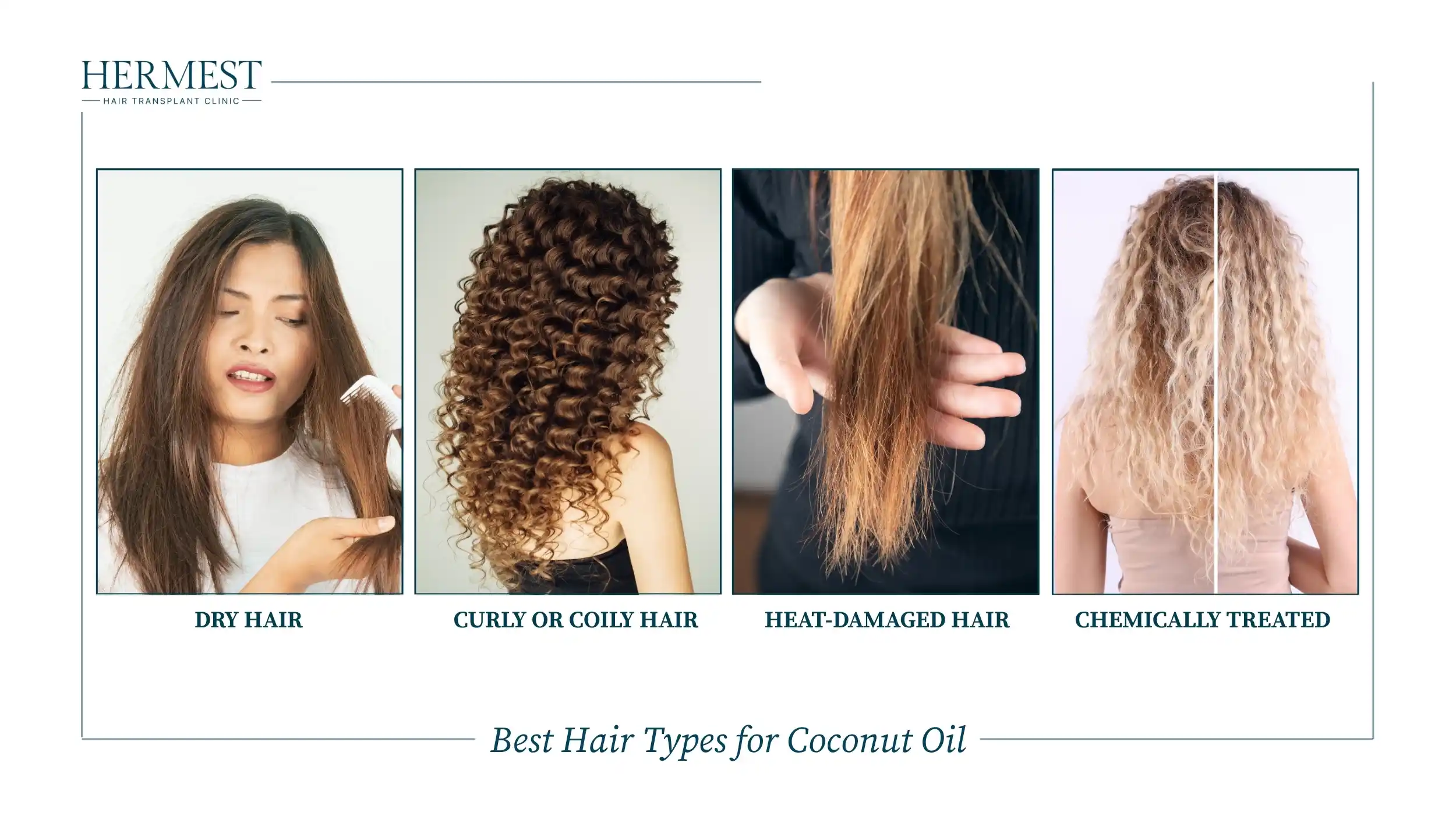 Hair types that suit coconut oil: dry, curly or coily, heat-damaged and chemically treated hair