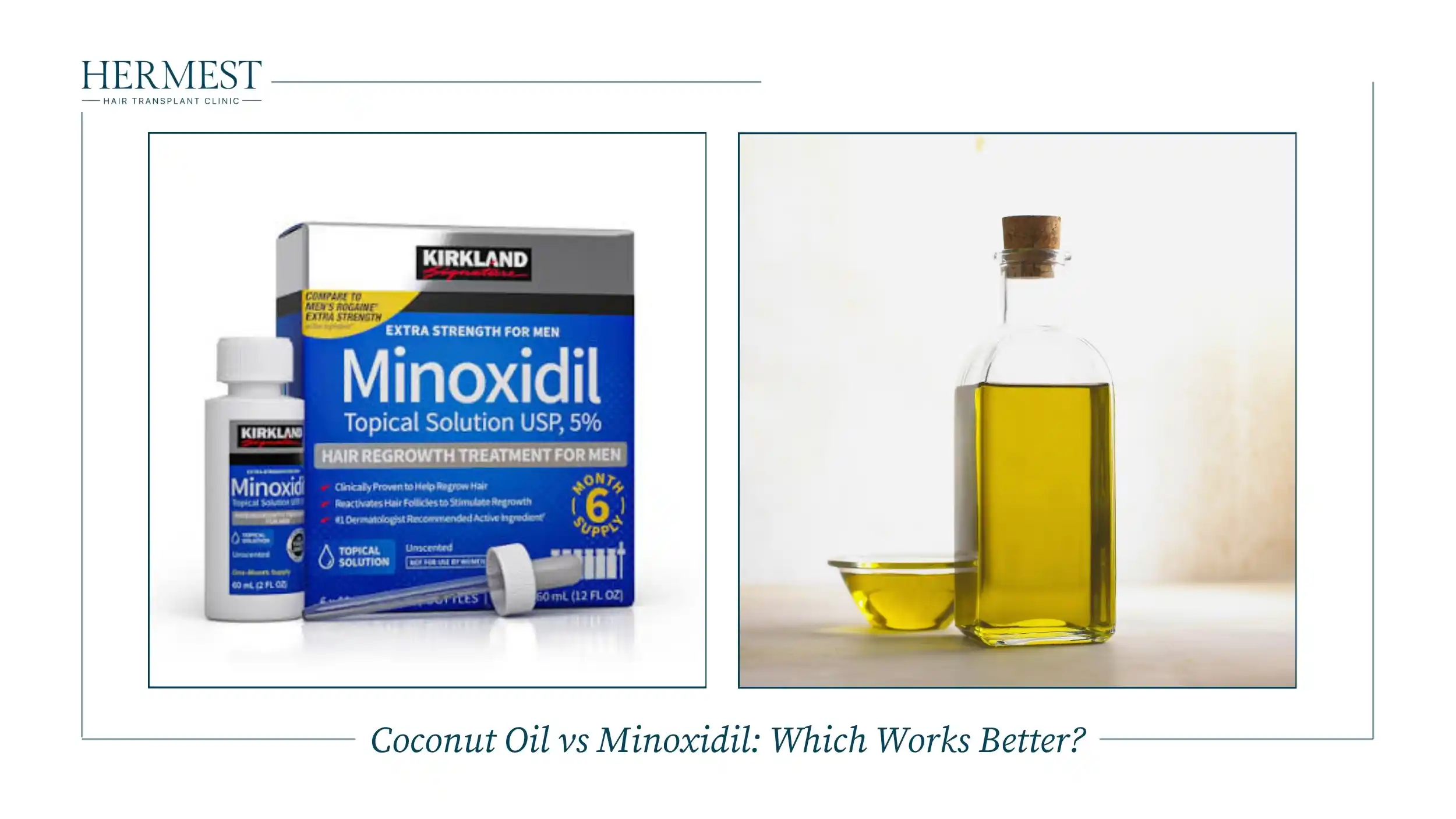 Minoxidil 5% topical solution next to a bottle of coconut oil, comparing hair loss treatments