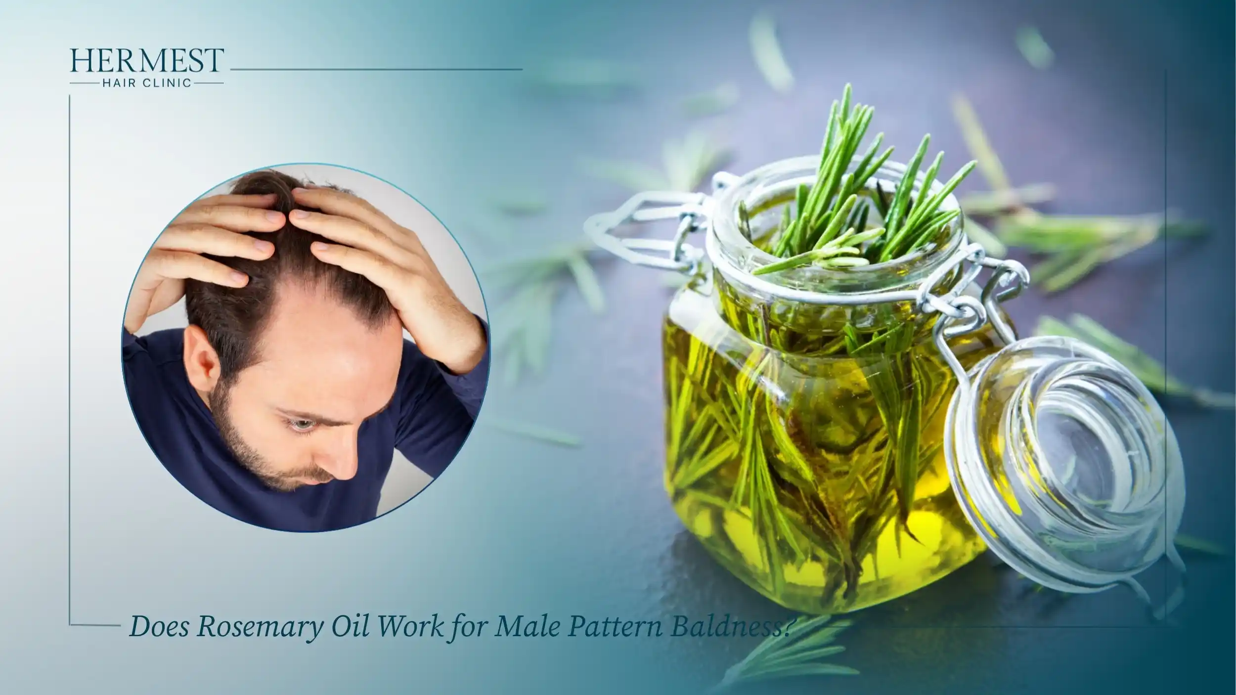 Glass jar of rosemary oil with fresh rosemary sprigs, beside an inset of a man checking his thinning hairline