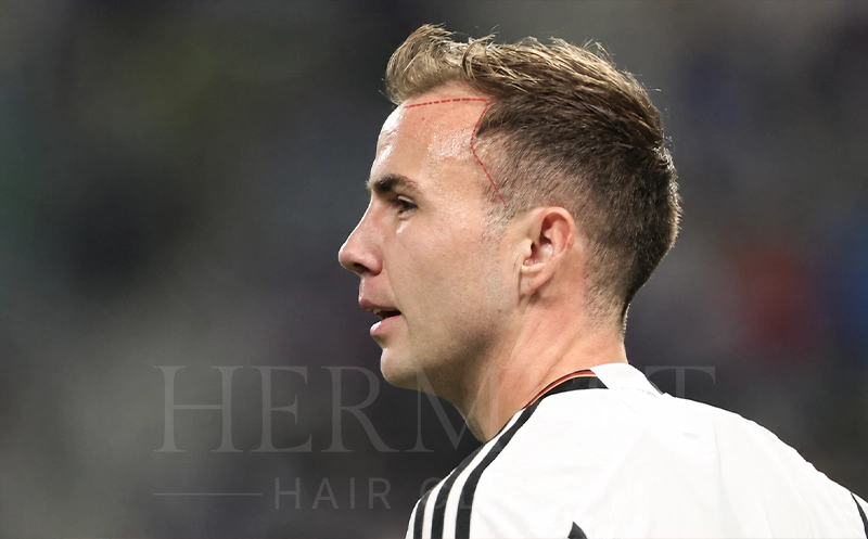 Fazit Was die Debatte um Mario Götze wirklich zeigt