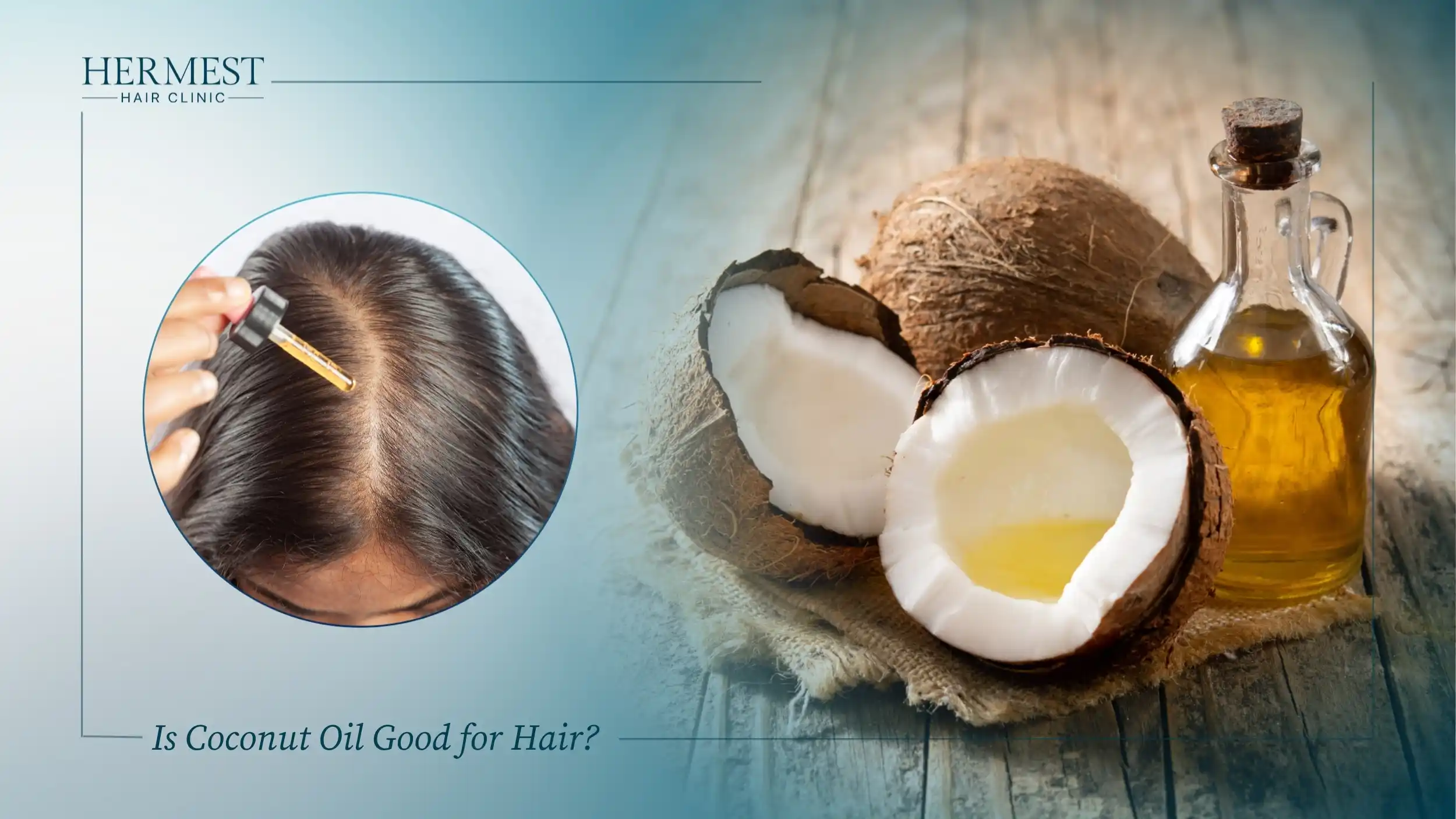 Coconut oil applied to the scalp with a dropper, shown beside a split coconut and oil bottle