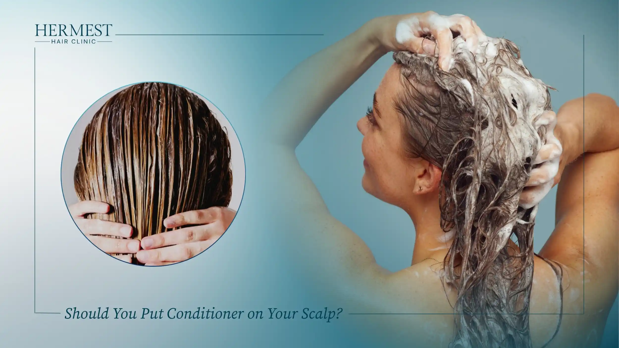 Should You Put Conditioner on Your Scalp