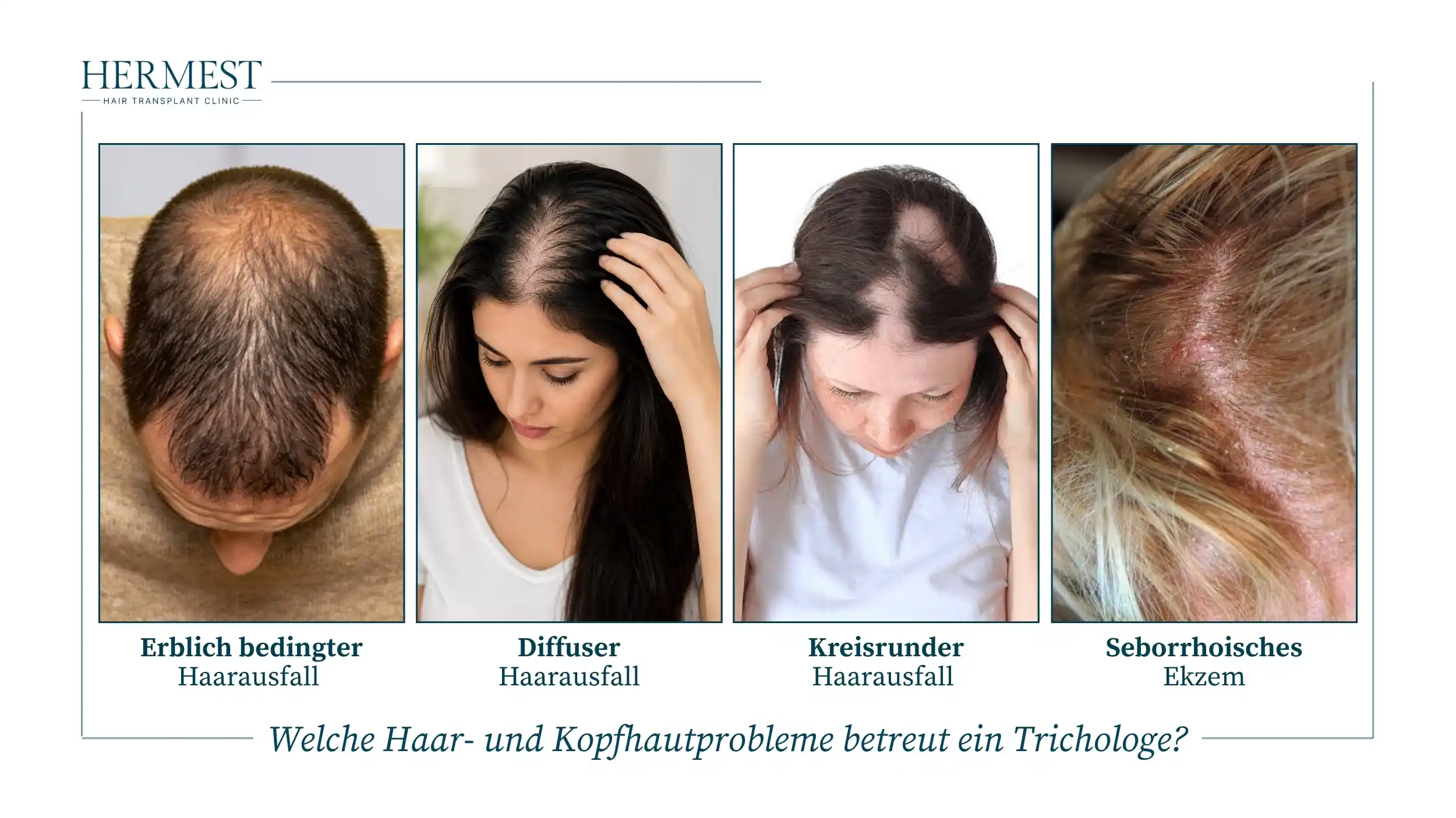 Welche Haar- und Kopfhautprobleme betreut ein Trichologe