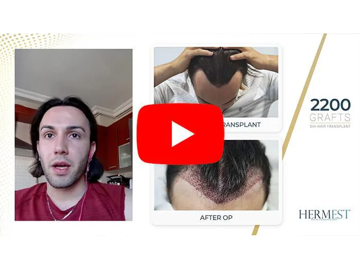 Video Gallery