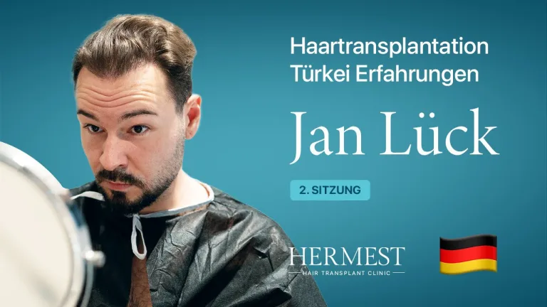 Jan — Hermest Haartransplantation Patientenbewertung