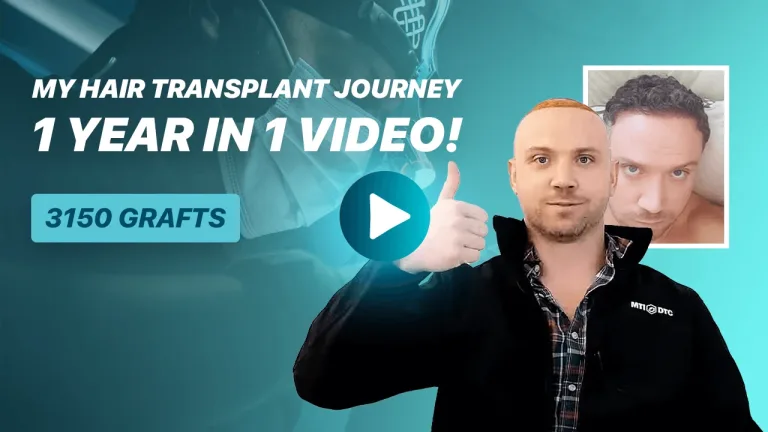 Andrew Hair Transplant