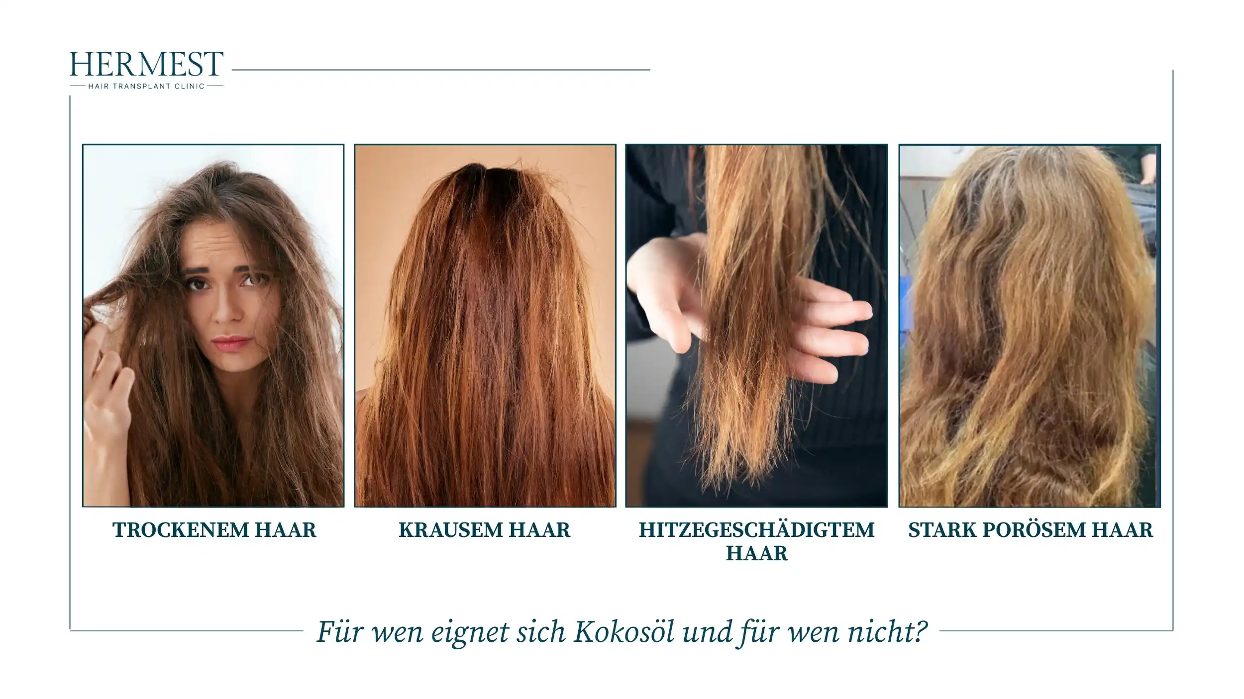 Für wen eignet sich Kokosöl und für wen nicht