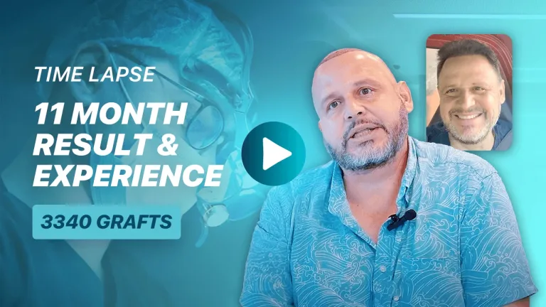 Juan C. V. Hair Transplant