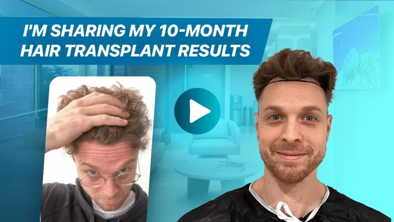 Matthew Hair Transplant
