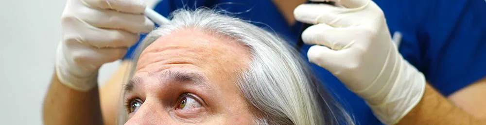 donor area hair transplant preparation