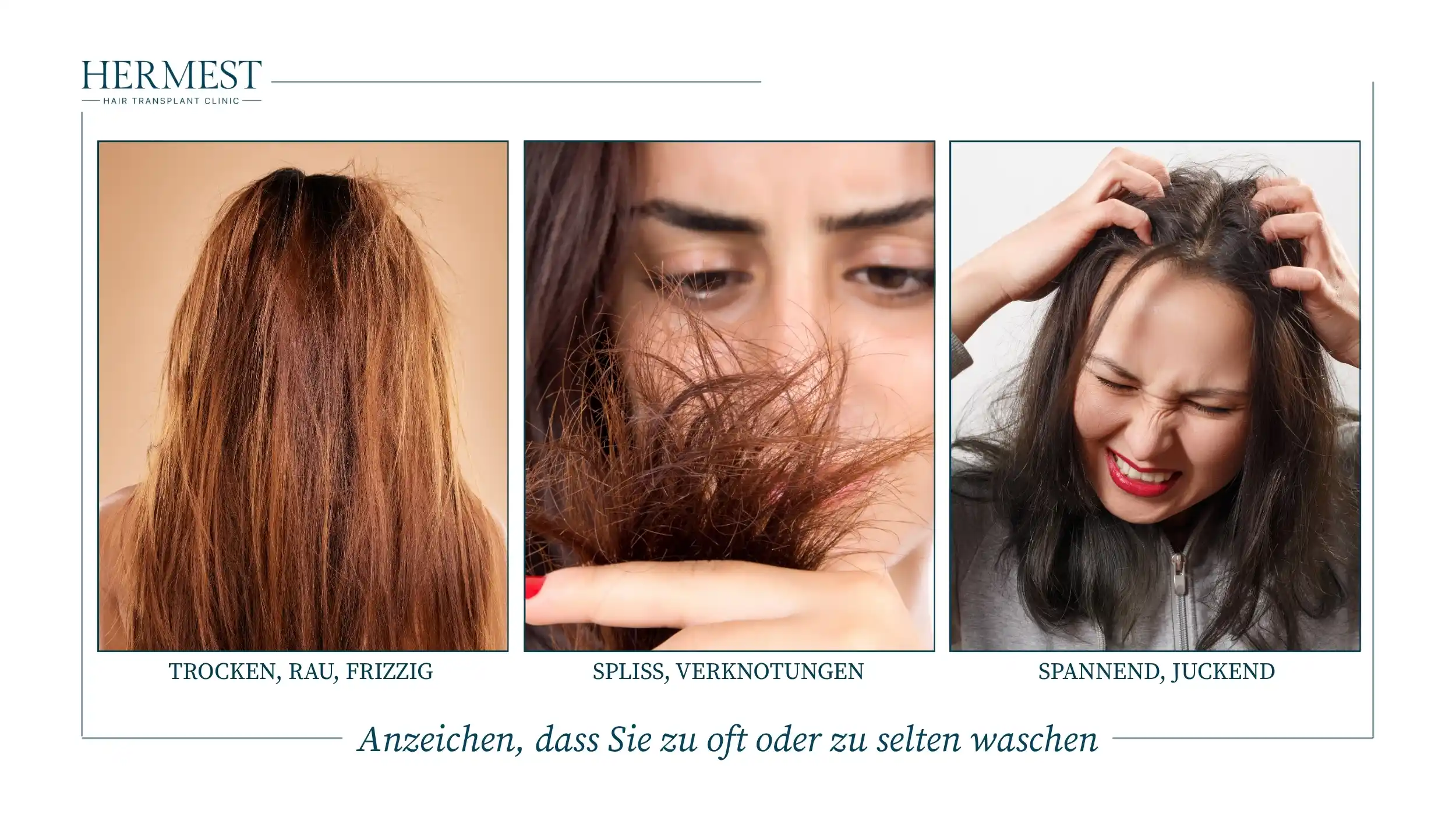 Anzeichen, dass Sie zu oft oder zu selten waschen: trockenes, raues Haar, Spliss und eine spannende, juckende Kopfhaut