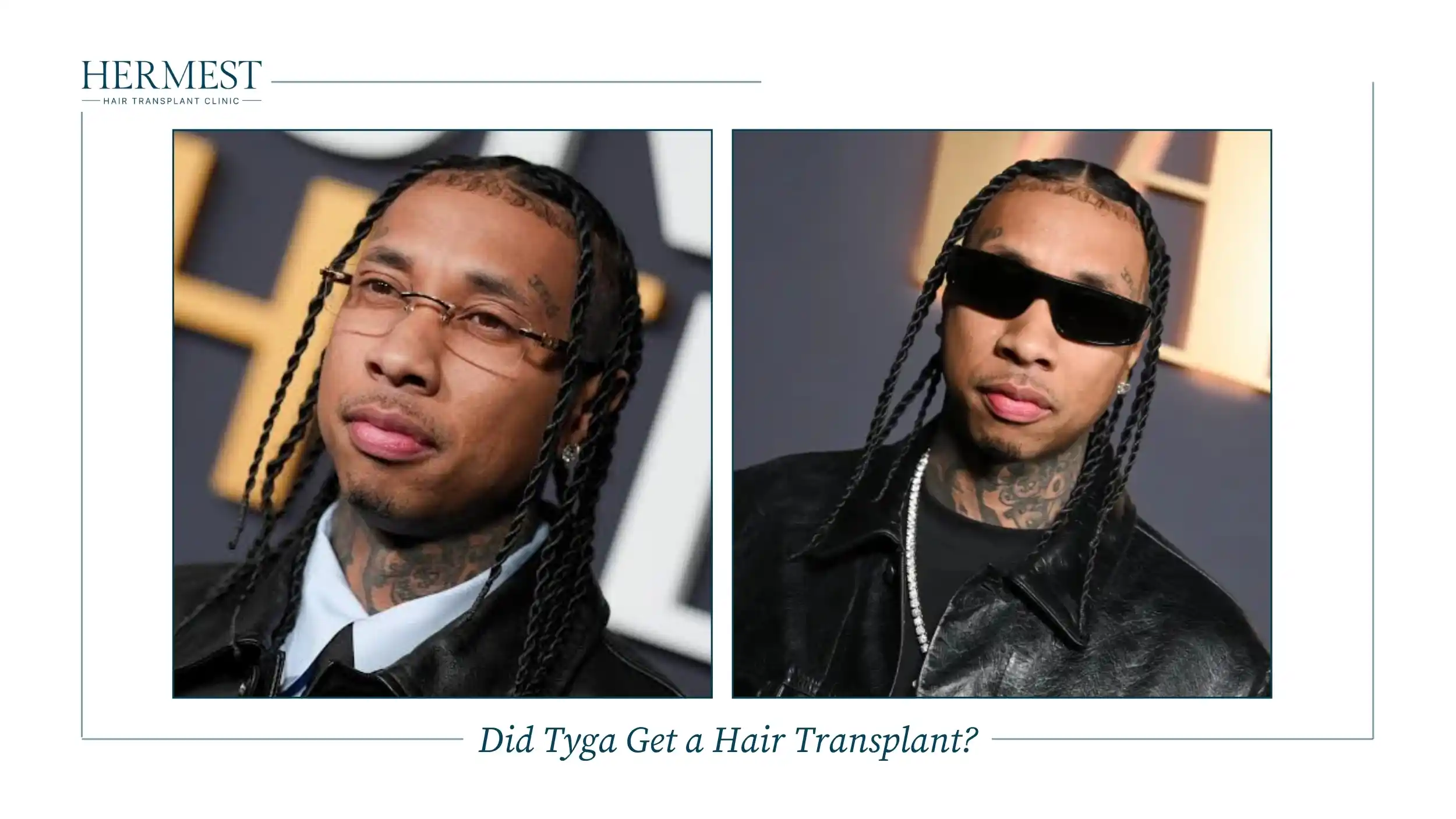 Two recent photos of Tyga wearing long twisted braids at red carpet events