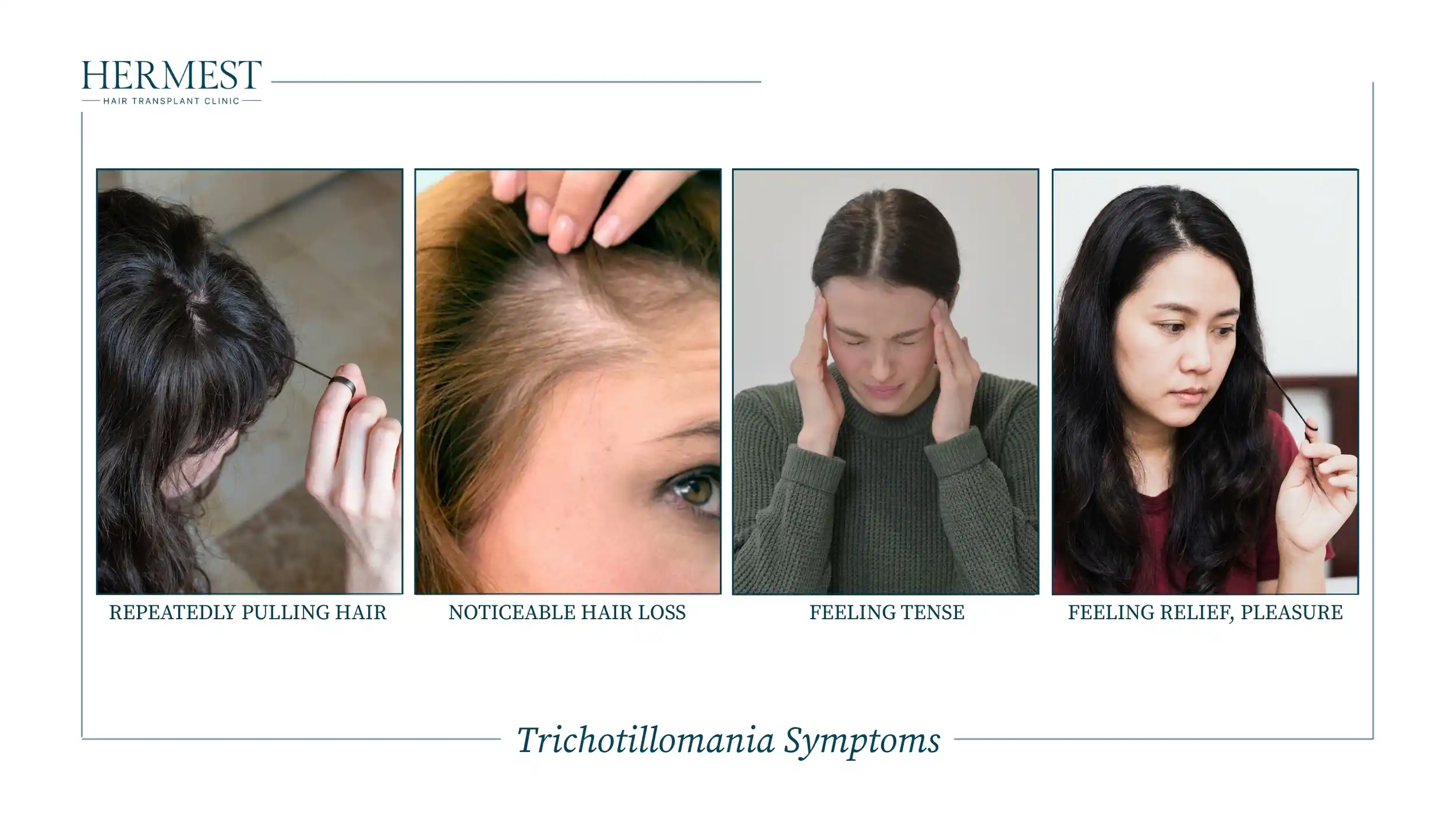 Trichotillomania Symptoms