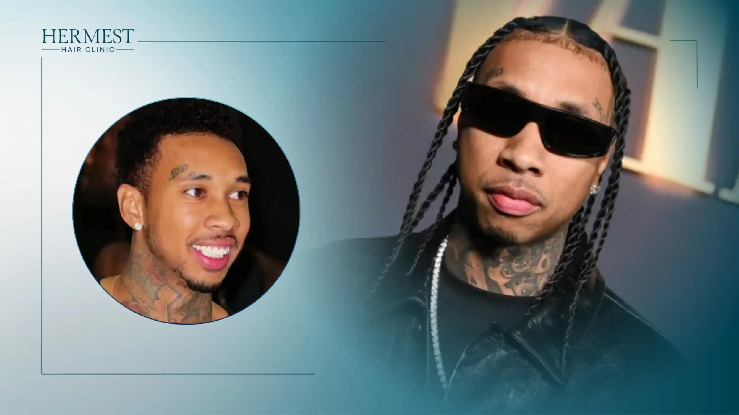 Tyga in braids and dark sunglasses, with an inset photo of Tyga with short curly hair
