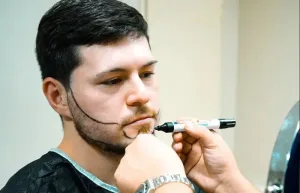 Homme barbu se faisant marquer le contour de la barbe avant une greffe de barbe