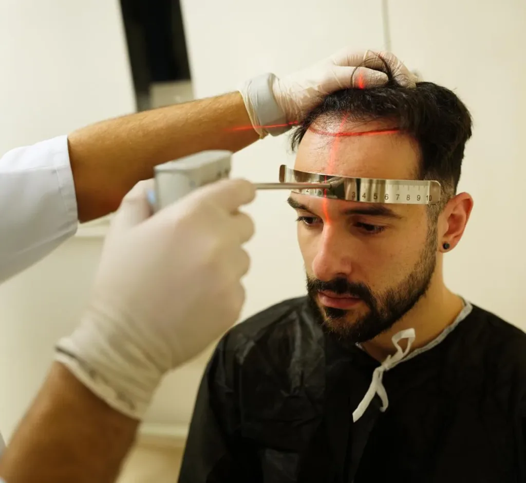 Ligne frontale d'un patient planifiée avec une règle et un repère laser
