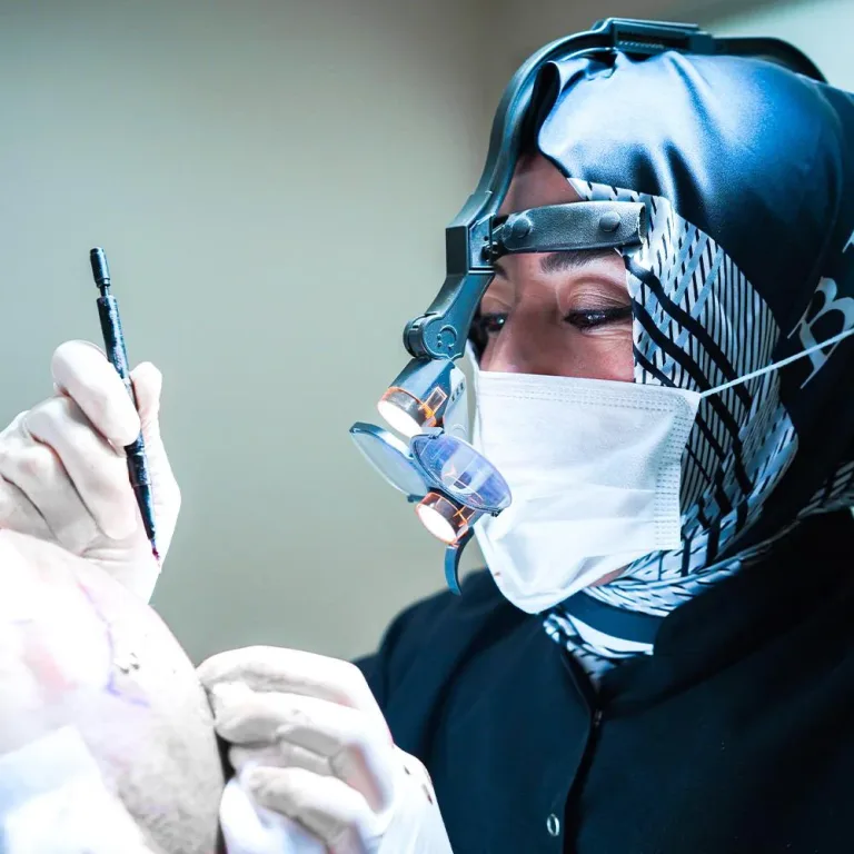 Chirurgienne en foulard avec loupes tenant un stylo implanteur pendant une greffe de cheveux